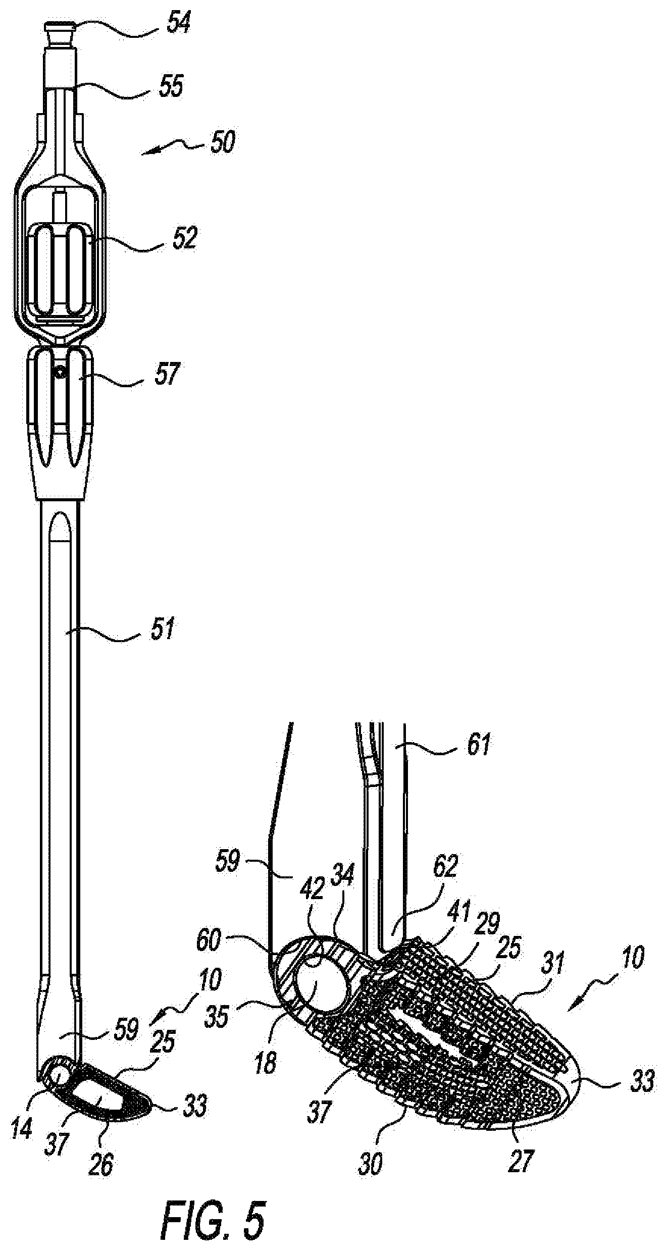 Patent US11793655 Figure 4 – Steerable spine implants