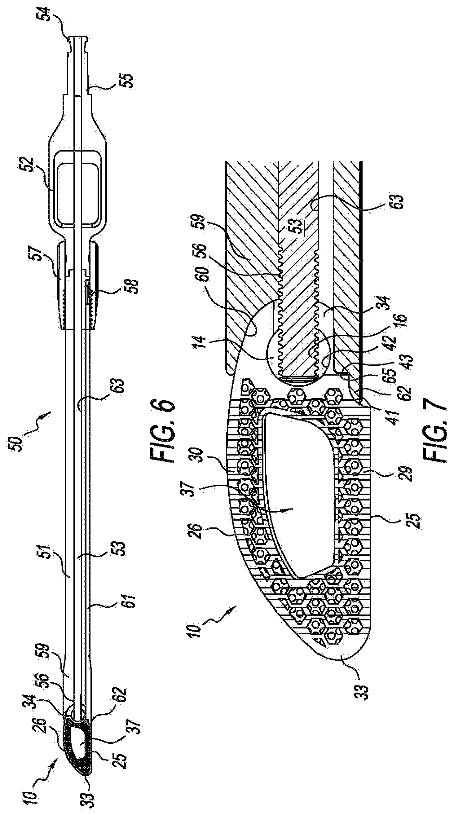 Patent US11793655 Figure 5 – Steerable spine implants