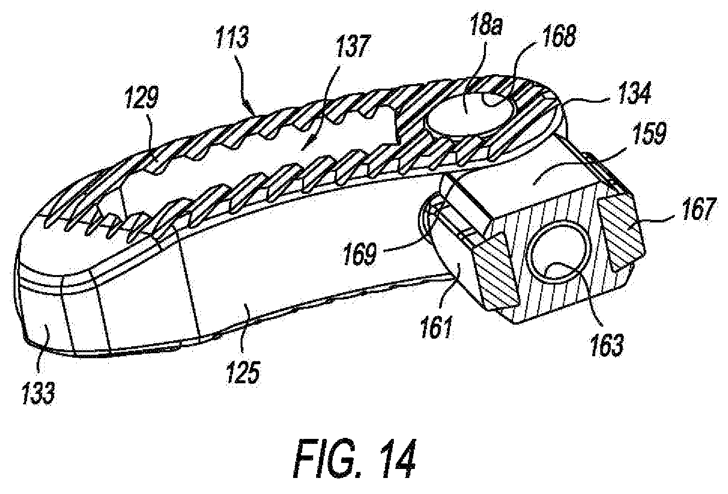 Patent US11793655 Figure 9 – Steerable spine implants