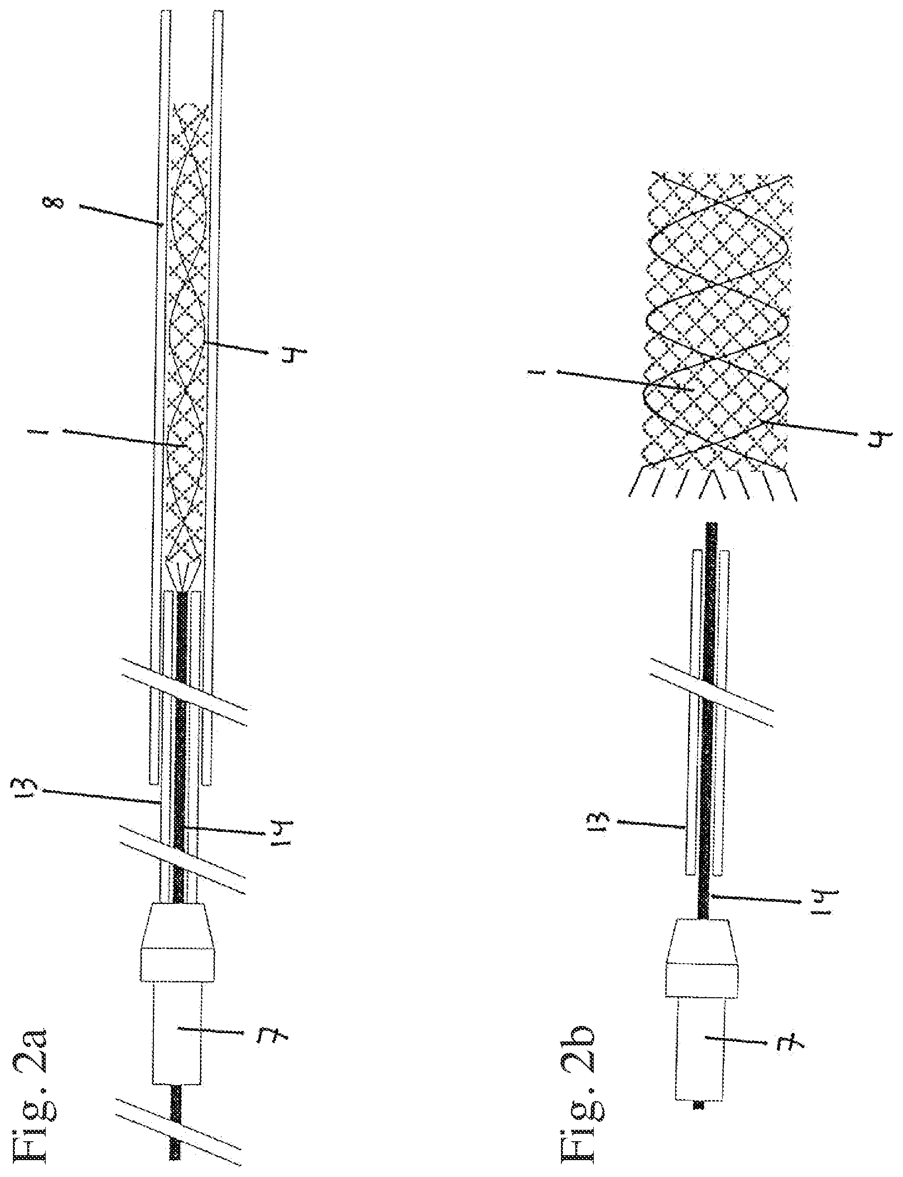 Patent US11793656 Figure 2 – Implant insertion system