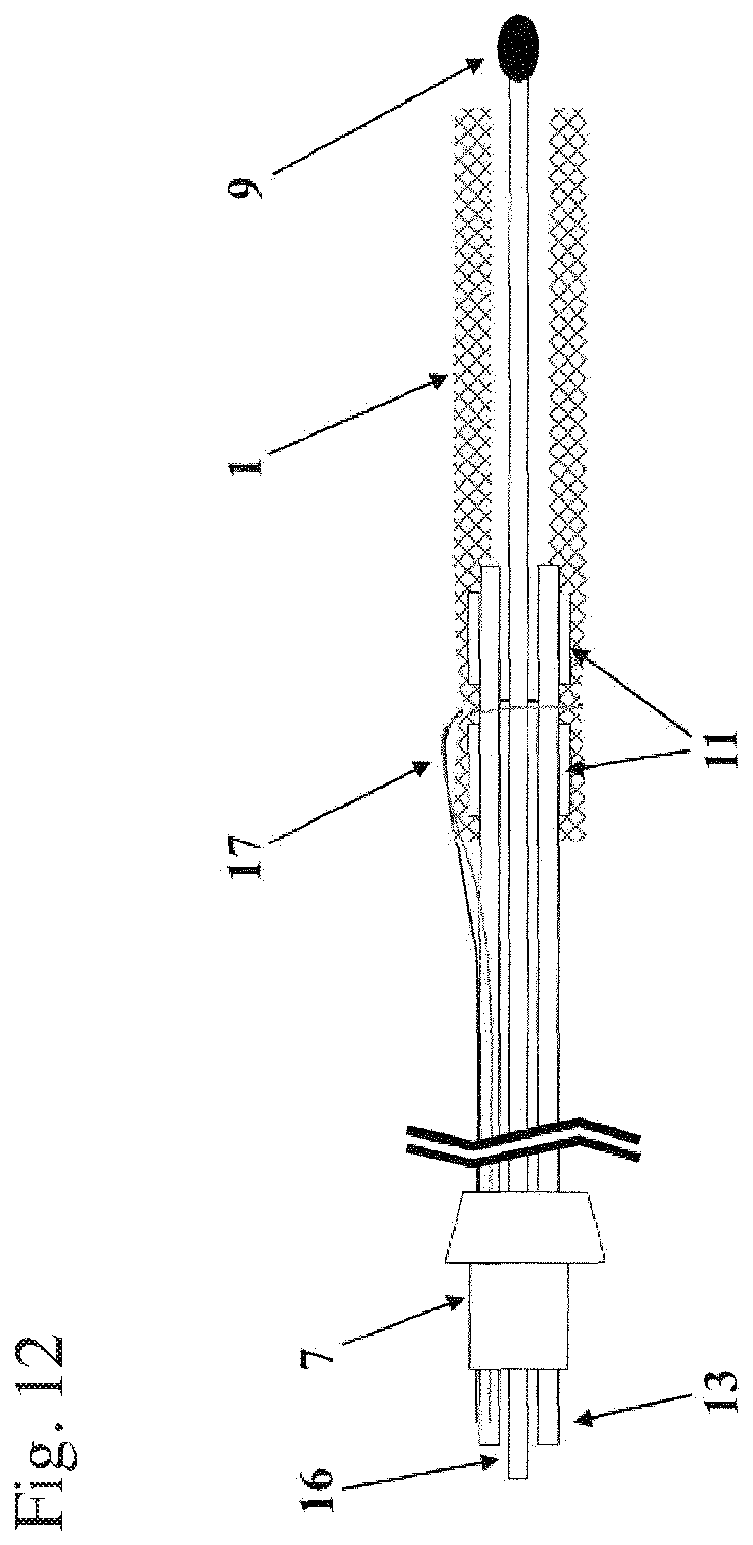 Patent US11793656 Figure 6 – Implant insertion system