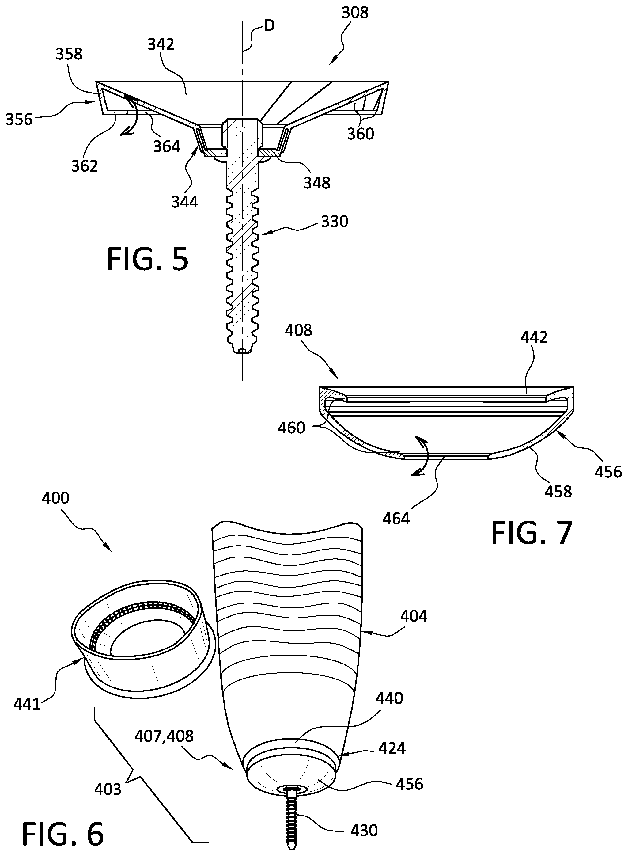 Patent US11793657 Figure 3 – Prosthetic socket system