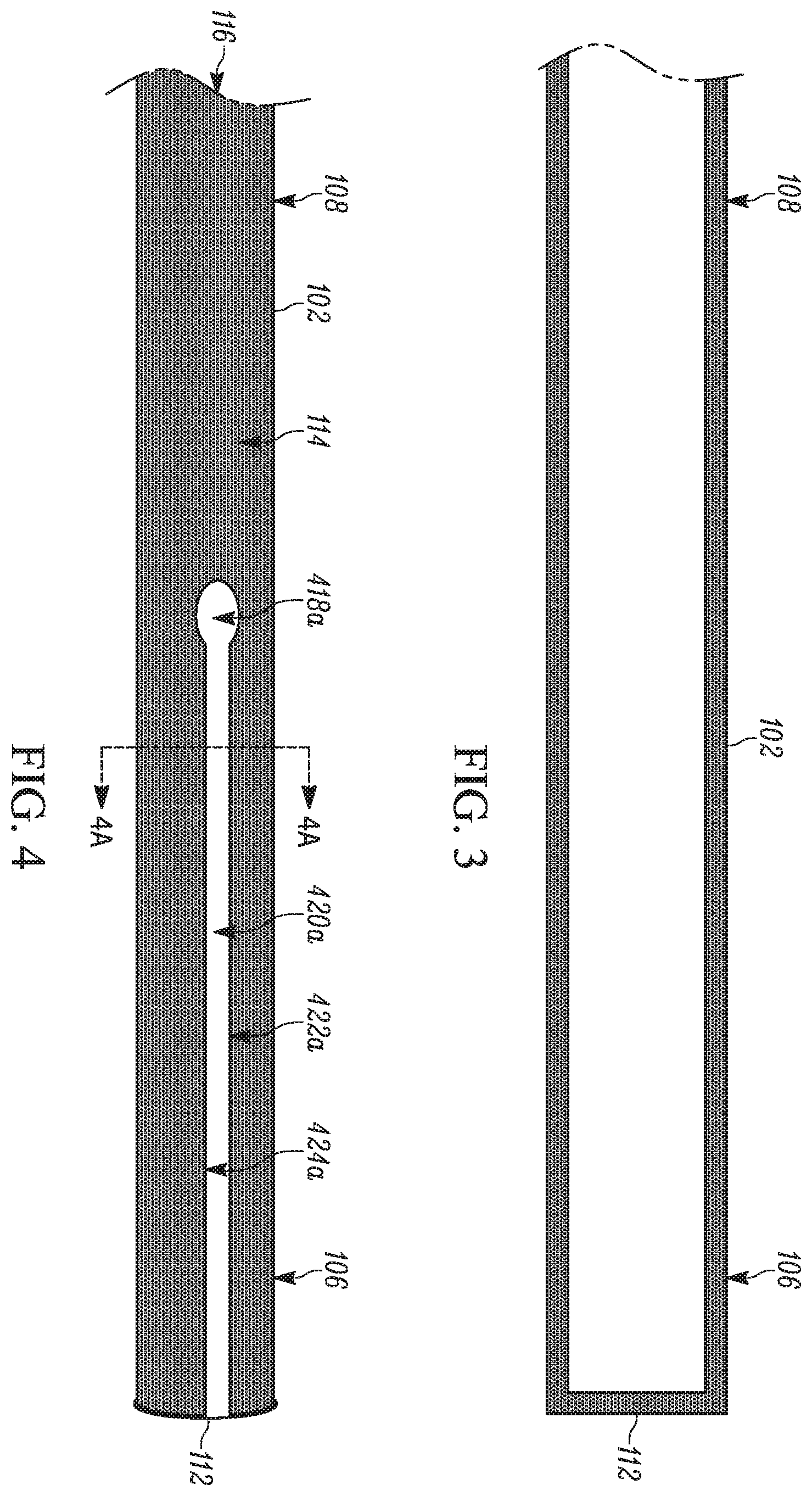 Patent US11793658 Figure 2 – Method and apparatuses for deploying an implant