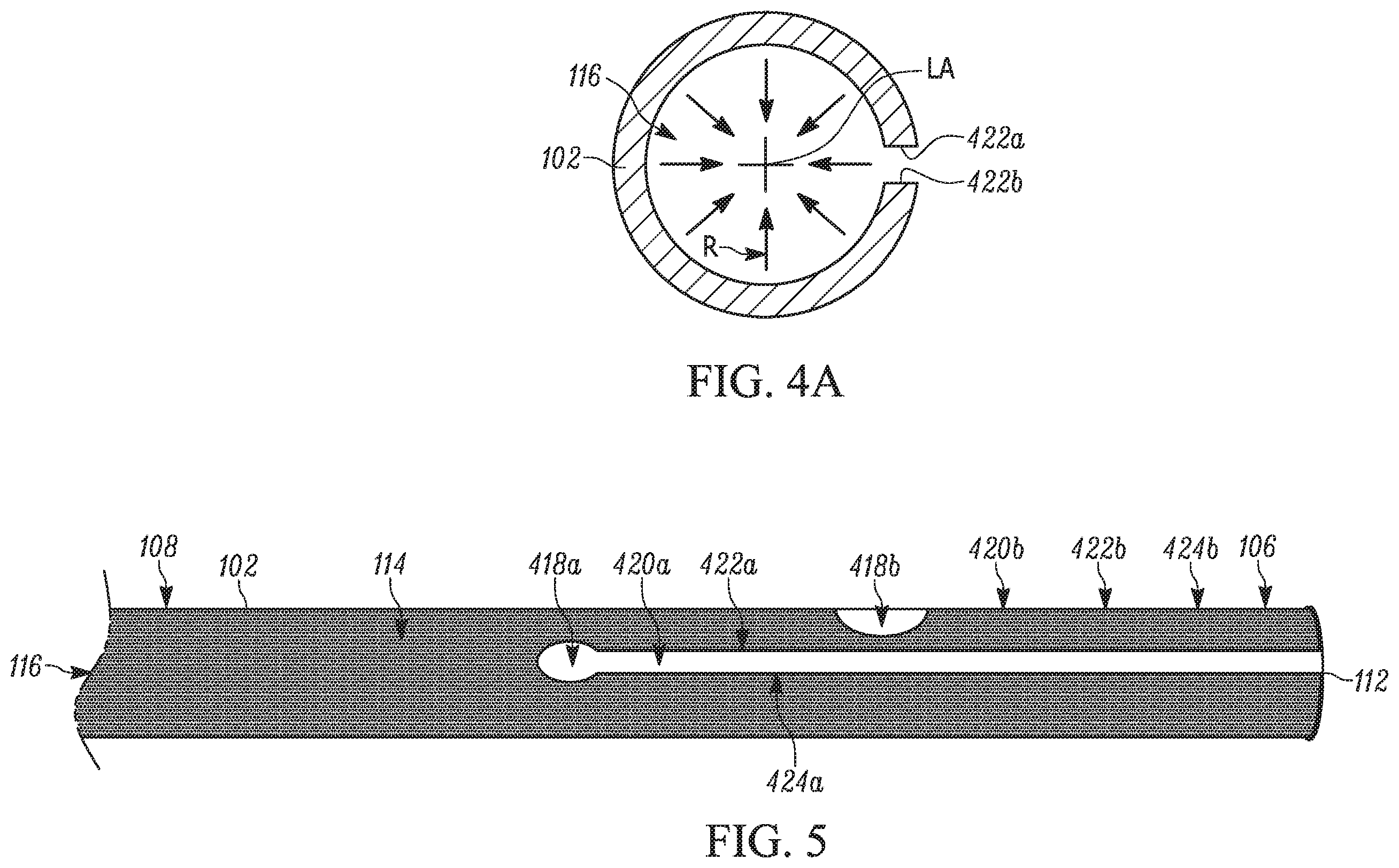 Patent US11793658 Figure 3 – Method and apparatuses for deploying an implant