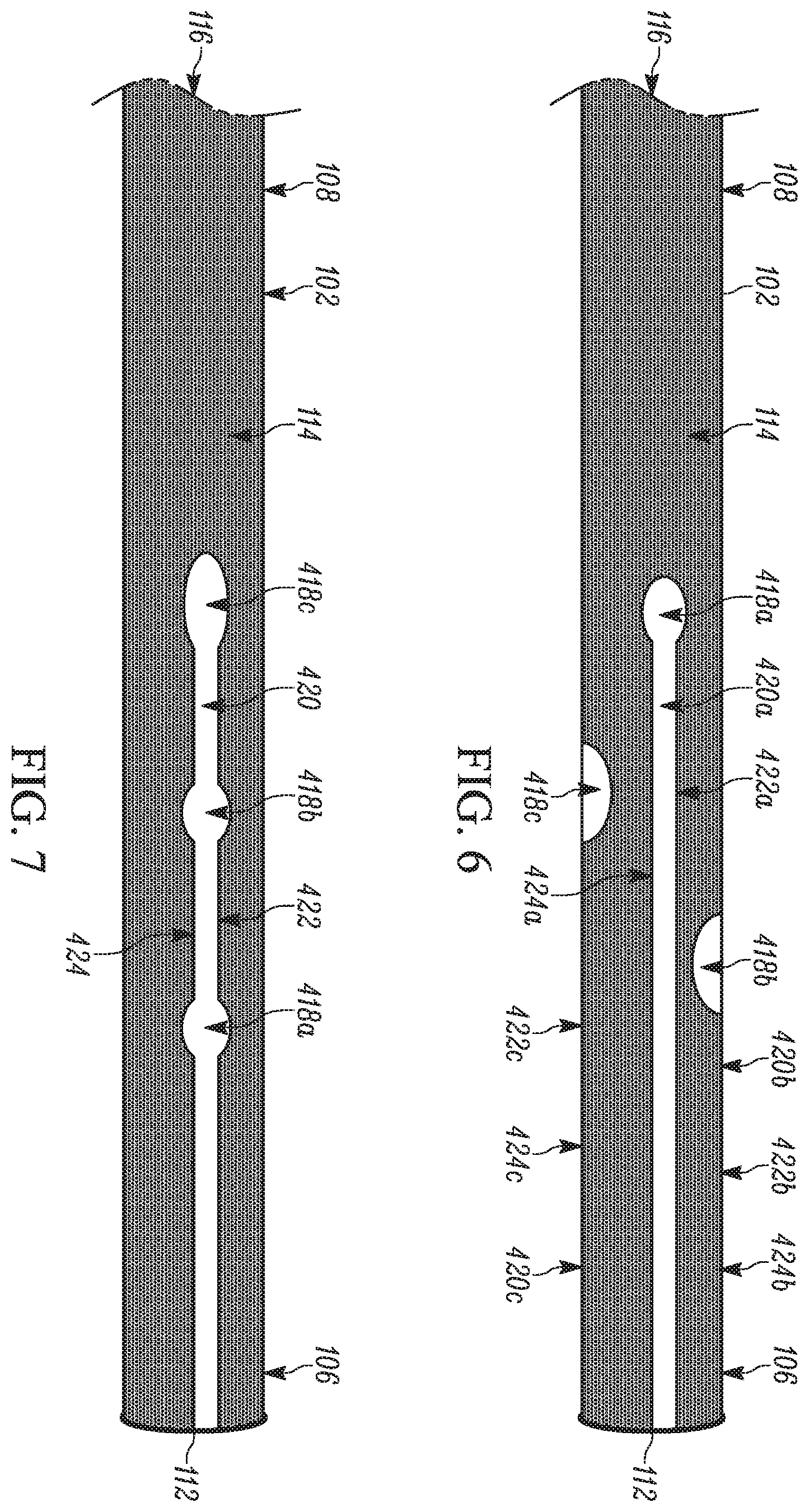 Patent US11793658 Figure 4 – Method and apparatuses for deploying an implant