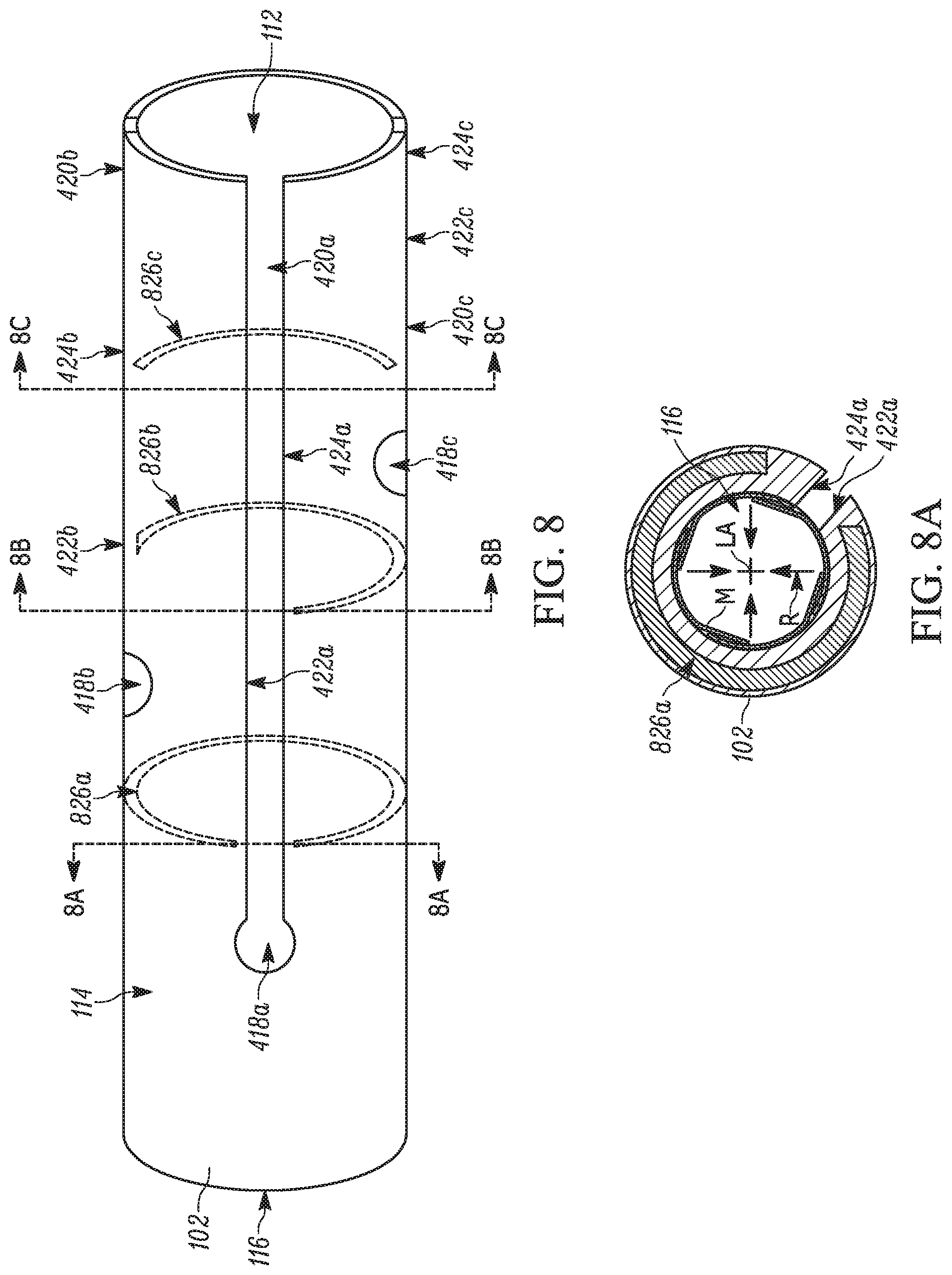 Patent US11793658 Figure 5 – Method and apparatuses for deploying an implant