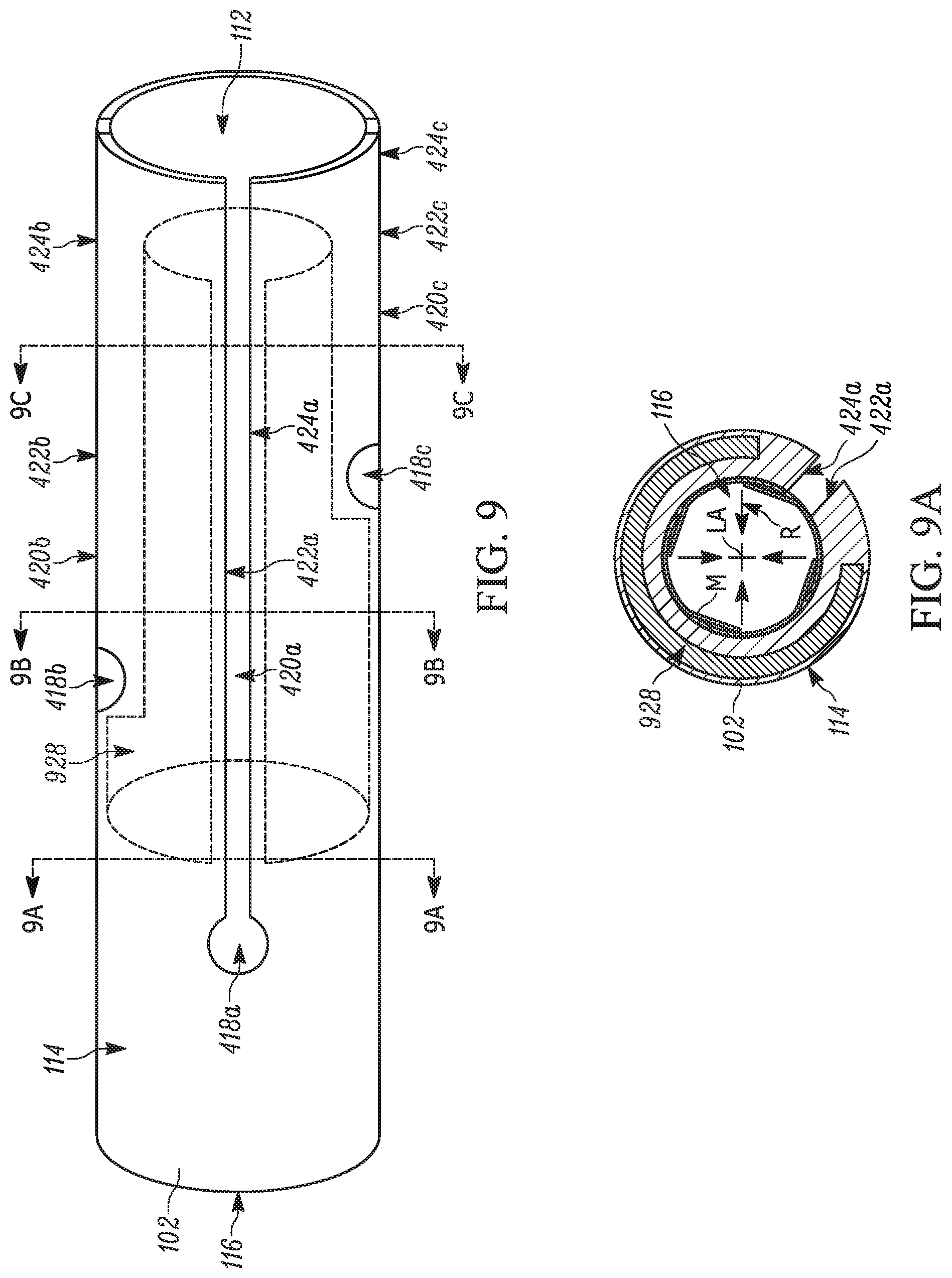 Patent US11793658 Figure 7 – Method and apparatuses for deploying an implant