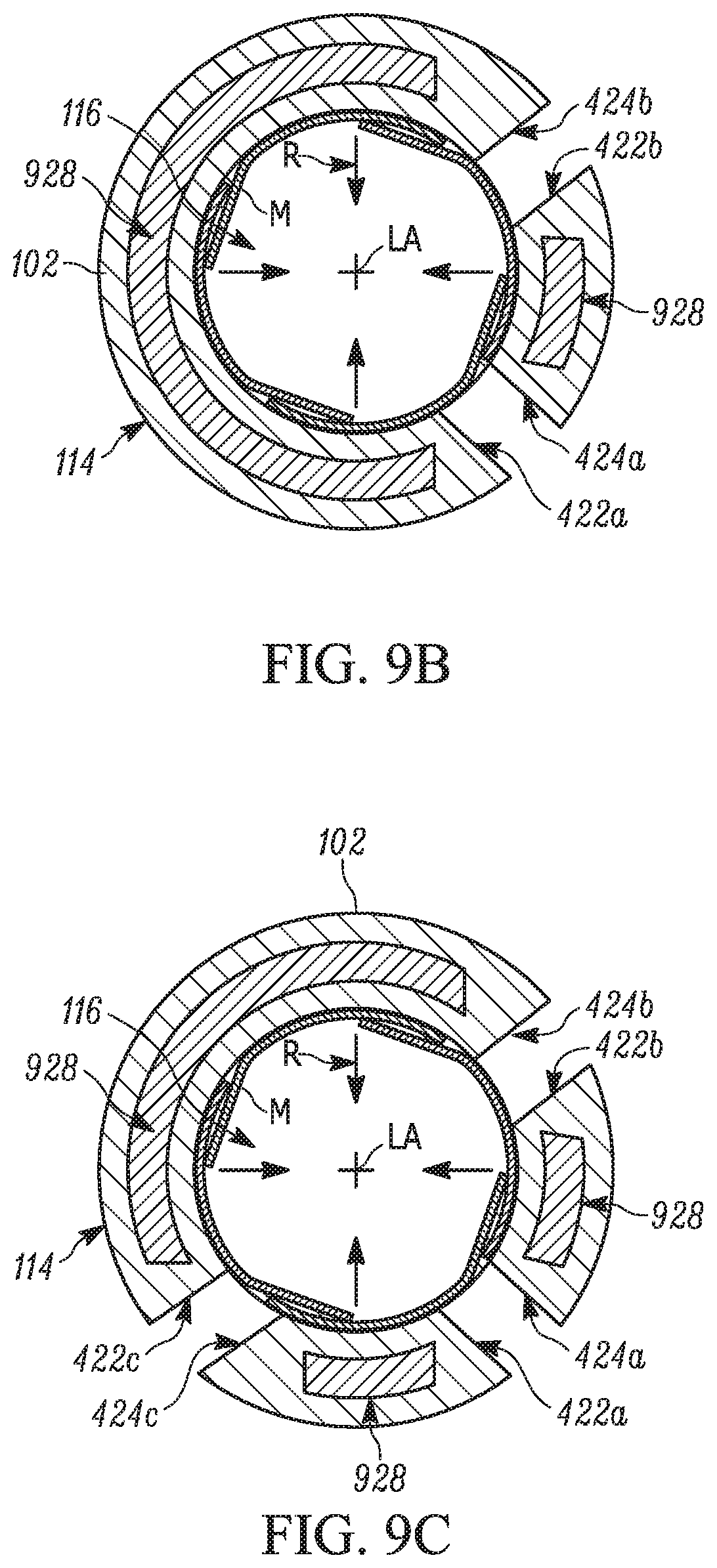 Patent US11793658 Figure 8 – Method and apparatuses for deploying an implant