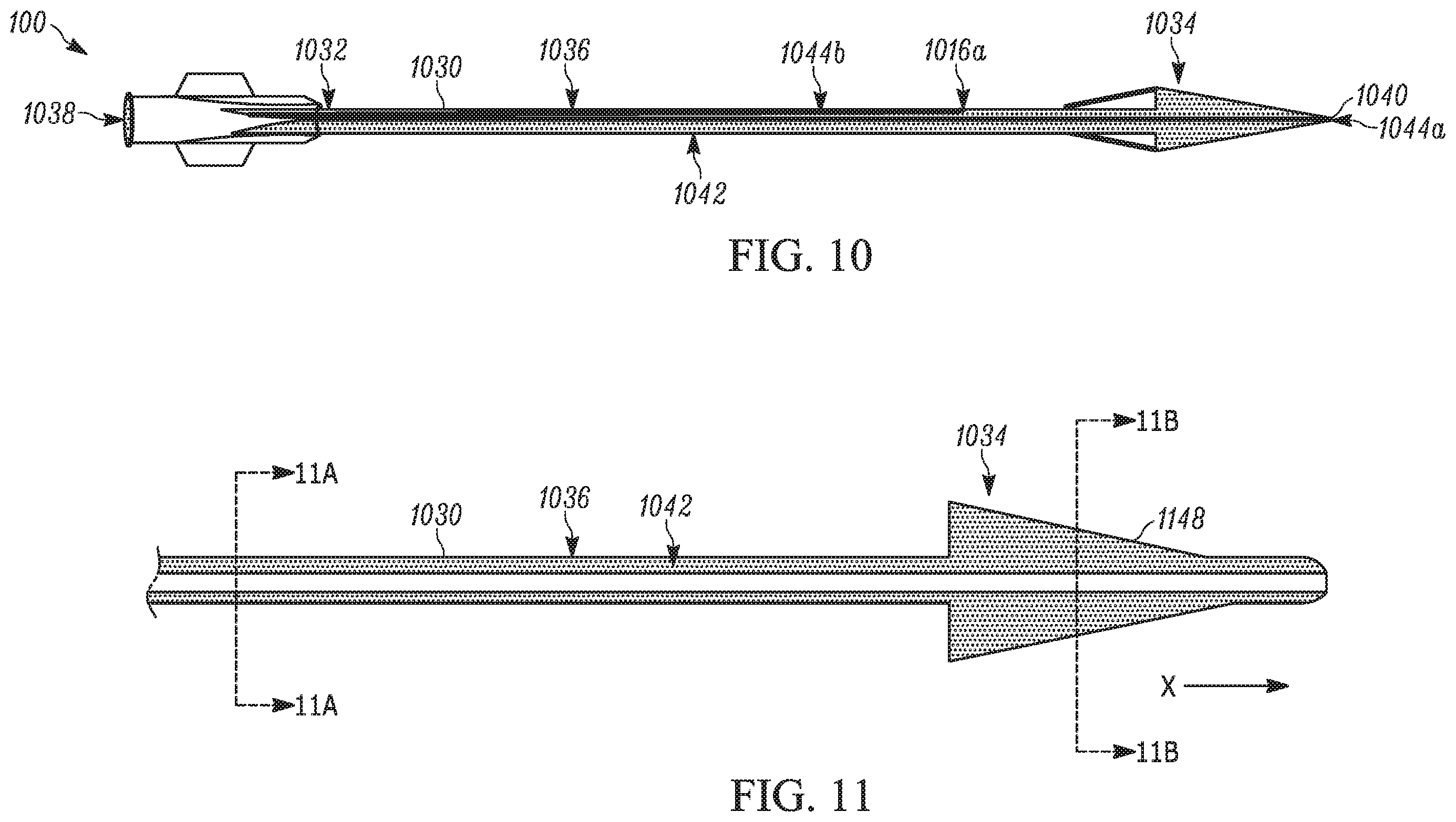 Patent US11793658 Figure 9 – Method and apparatuses for deploying an implant