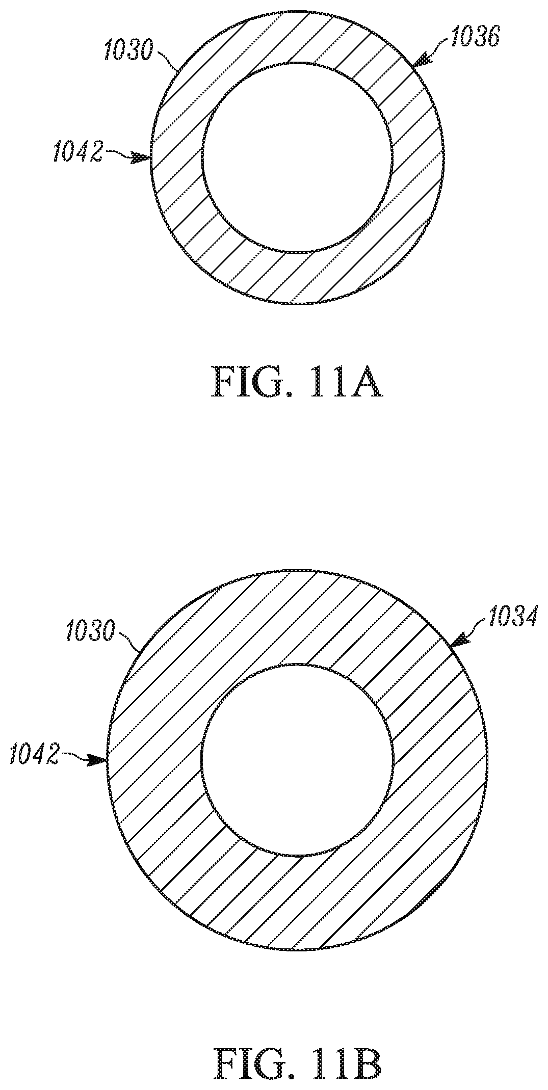 Patent US11793658 Figure 10 – Method and apparatuses for deploying an implant