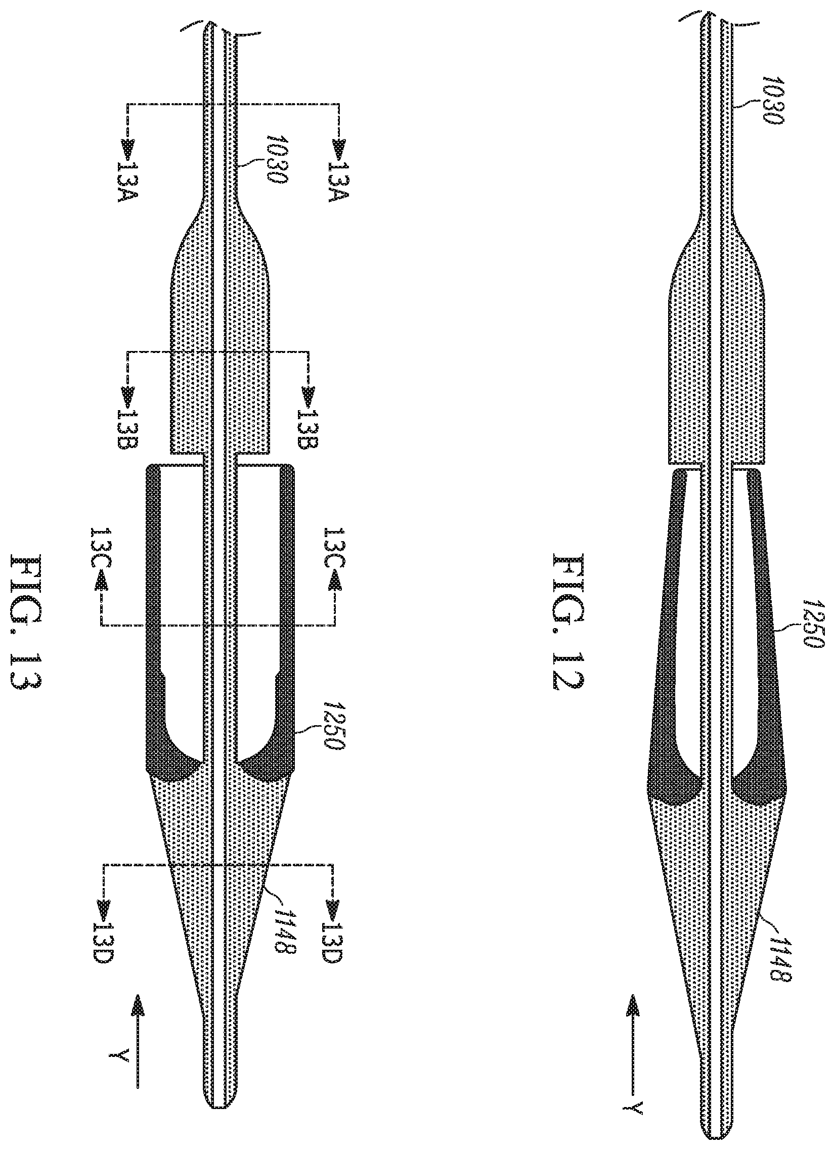 Patent US11793658 Figure 11 – Method and apparatuses for deploying an implant