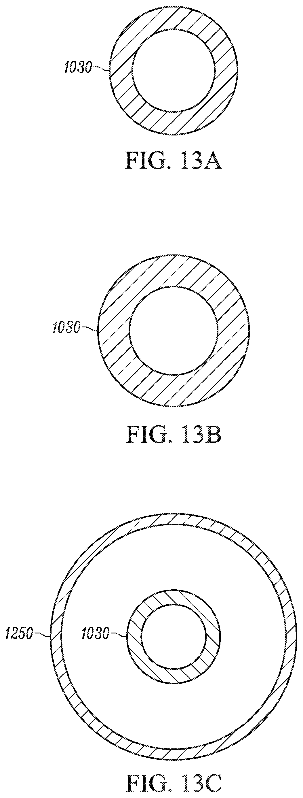 Patent US11793658 Figure 12 – Method and apparatuses for deploying an implant