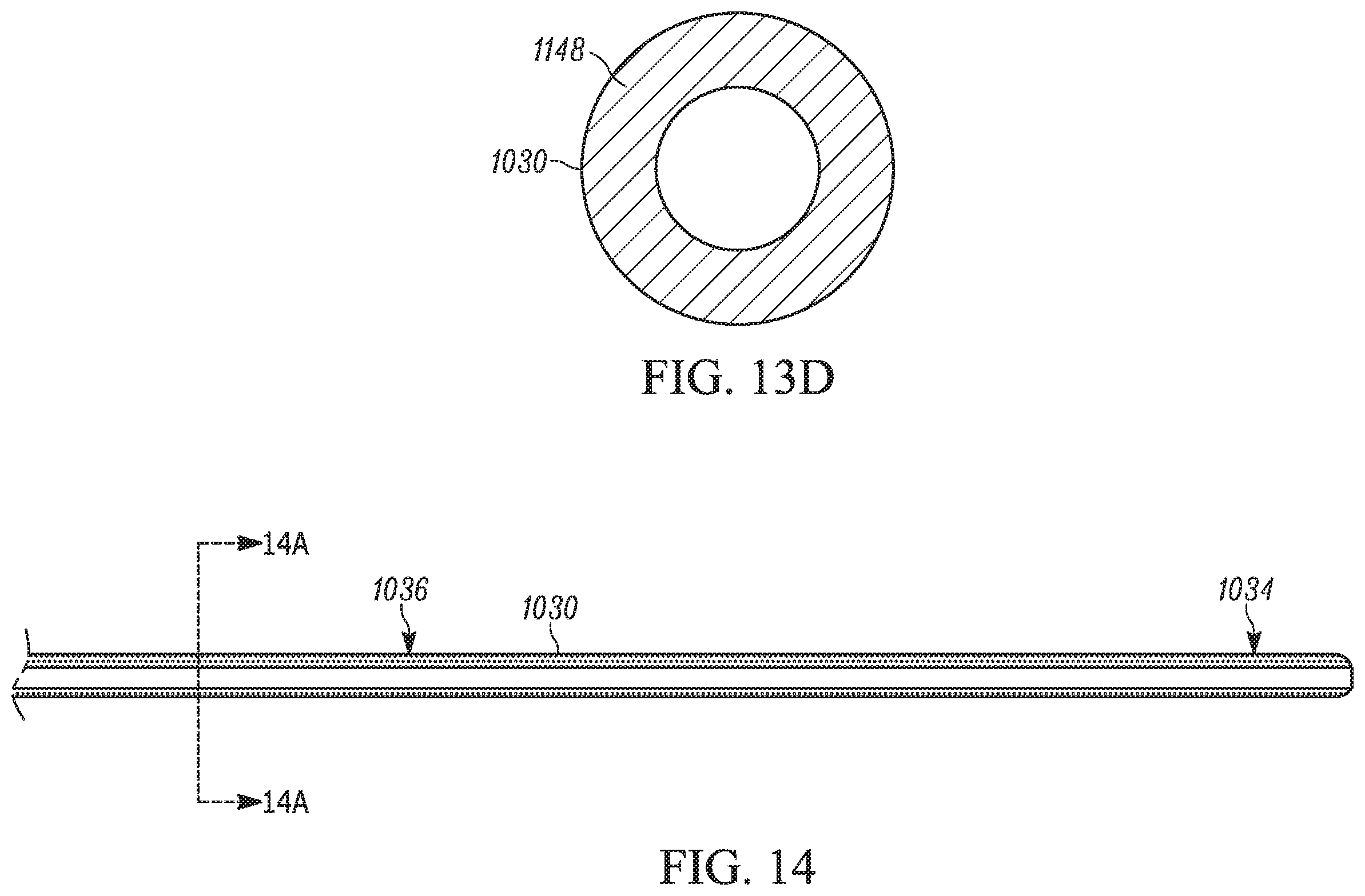 Patent US11793658 Figure 13 – Method and apparatuses for deploying an implant