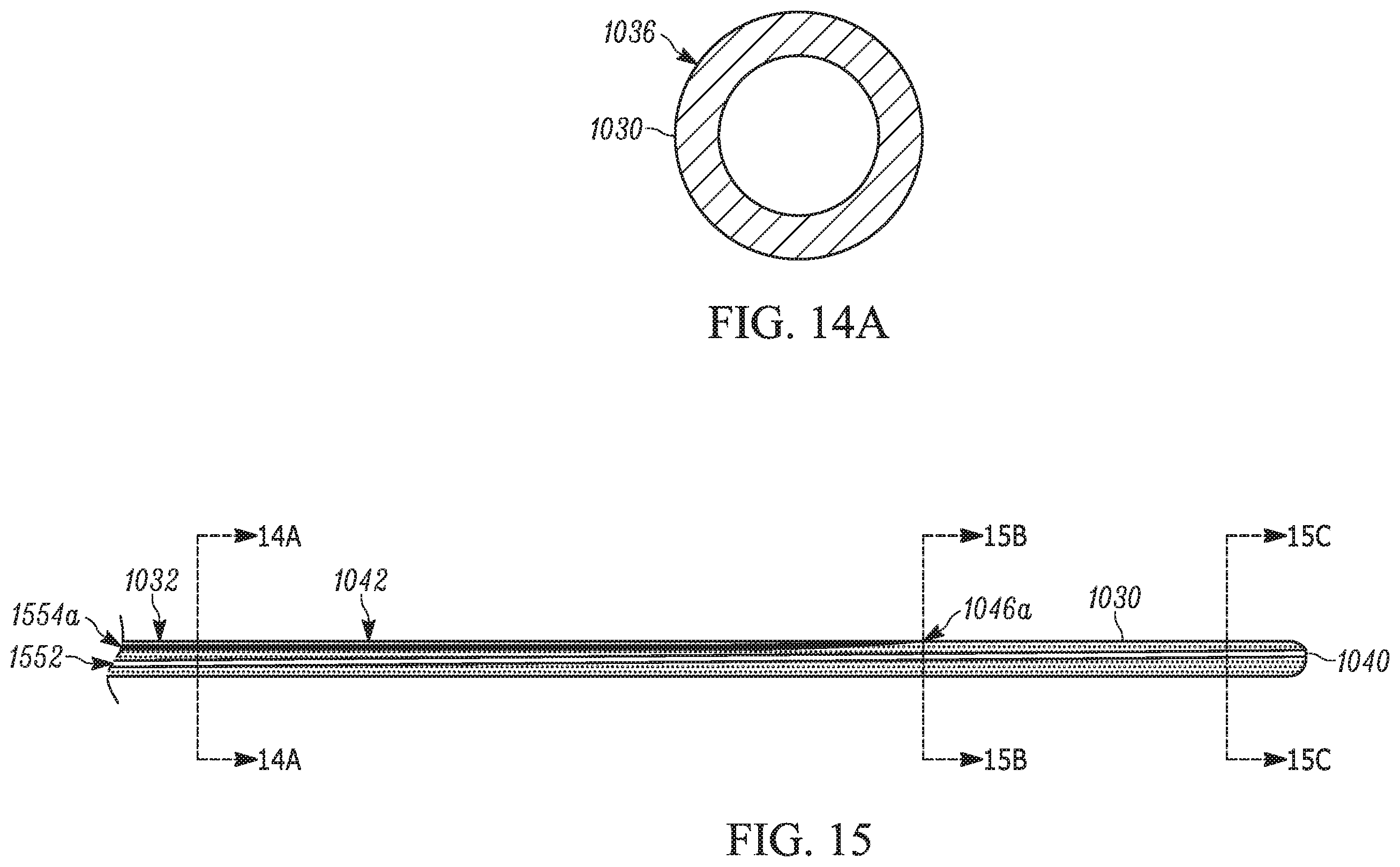 Patent US11793658 Figure 14 – Method and apparatuses for deploying an implant