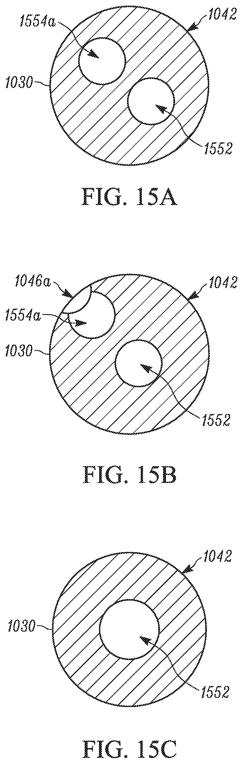 Patent US11793658 Figure 15 – Method and apparatuses for deploying an implant