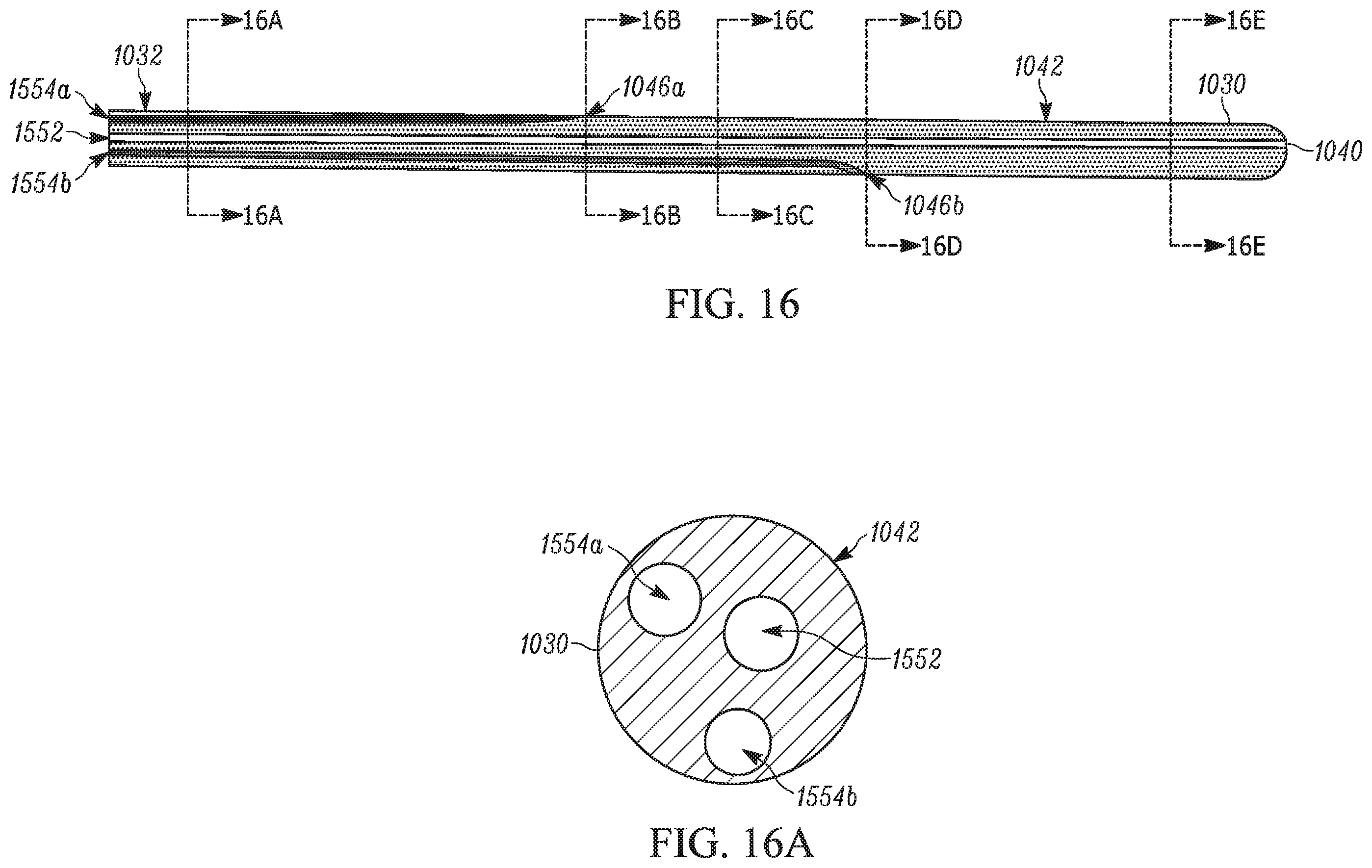 Patent US11793658 Figure 16 – Method and apparatuses for deploying an implant