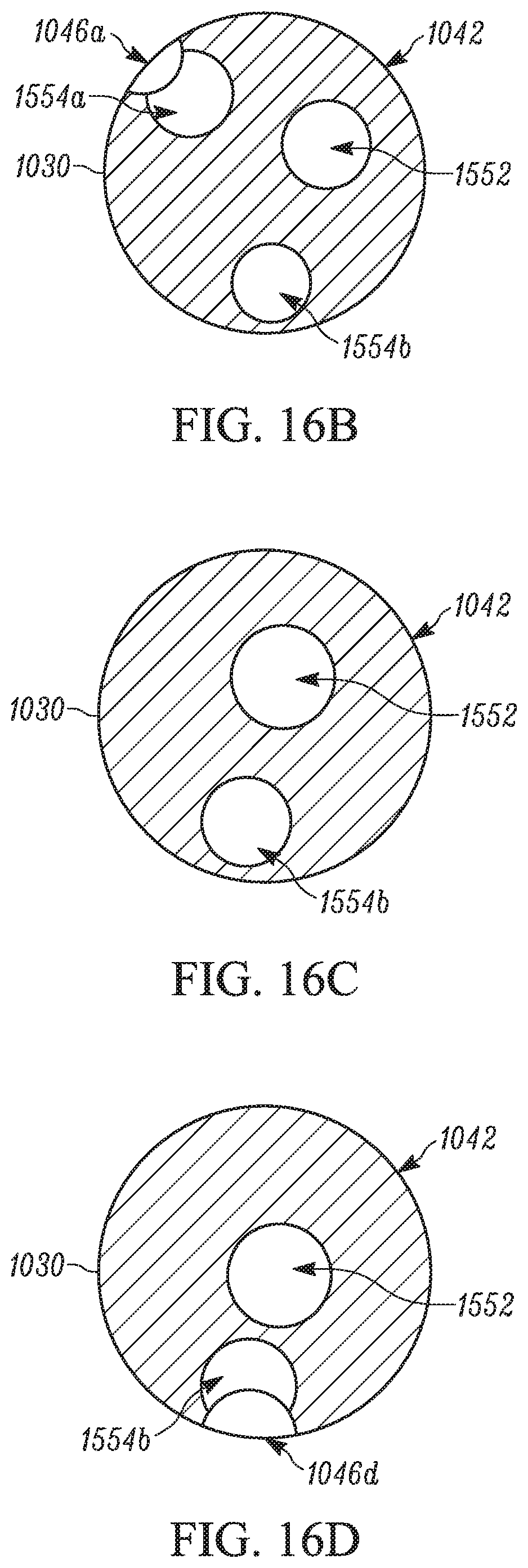 Patent US11793658 Figure 17 – Method and apparatuses for deploying an implant