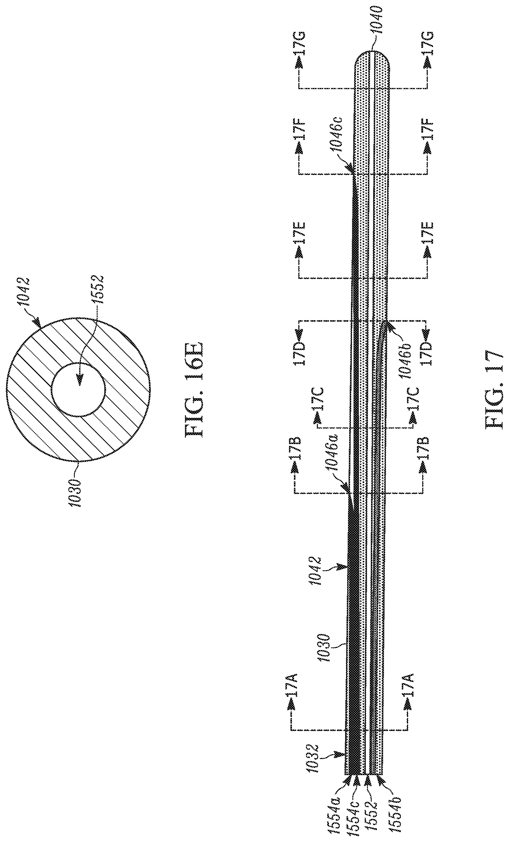 Patent US11793658 Figure 18 – Method and apparatuses for deploying an implant