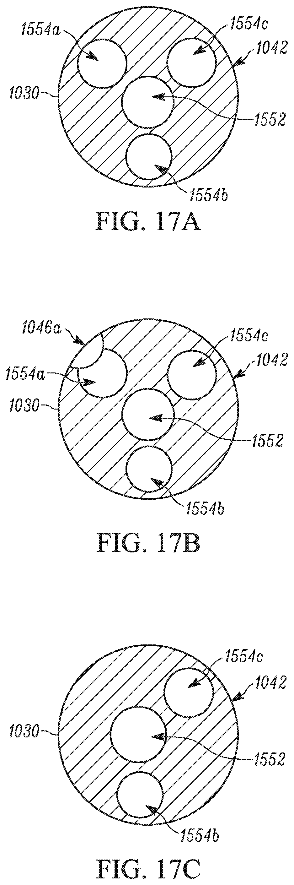 Patent US11793658 Figure 19 – Method and apparatuses for deploying an implant