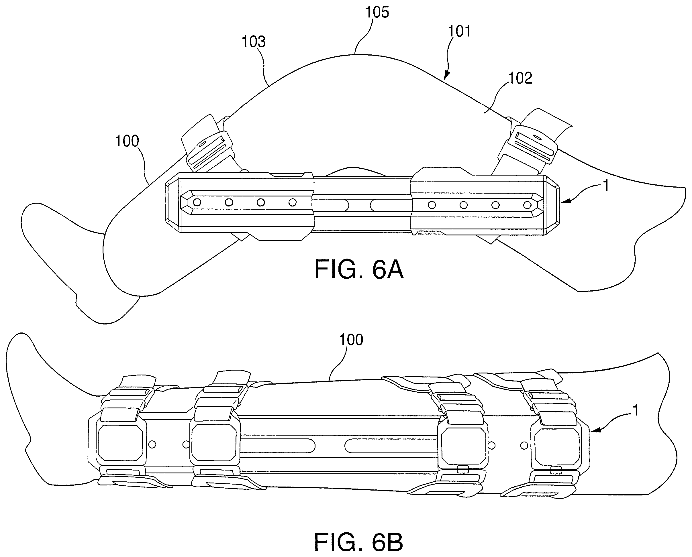 Patent US11793660 Figure 4 – Emergency limb fixation or restraining device