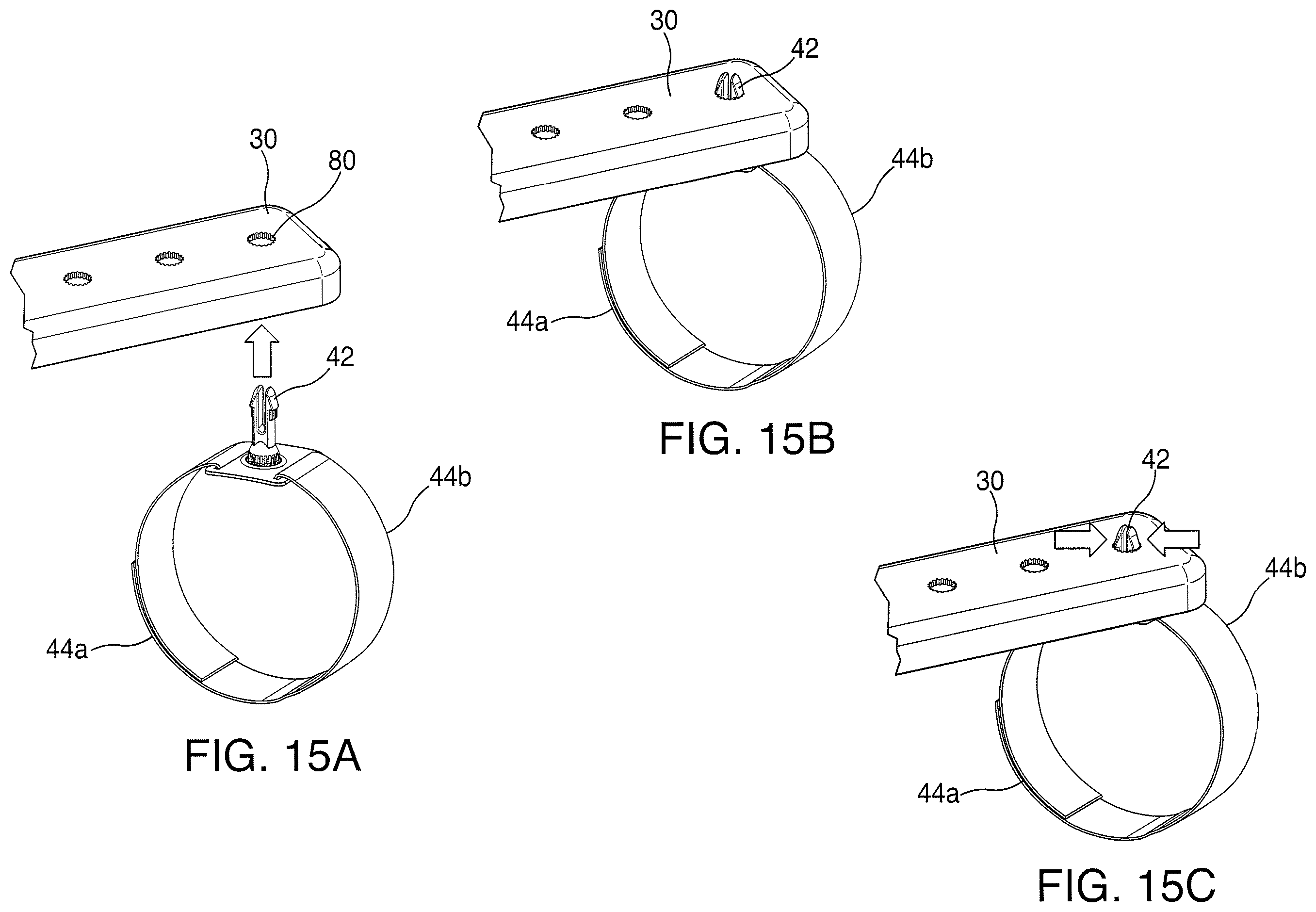 Patent US11793660 Figure 11 – Emergency limb fixation or restraining device