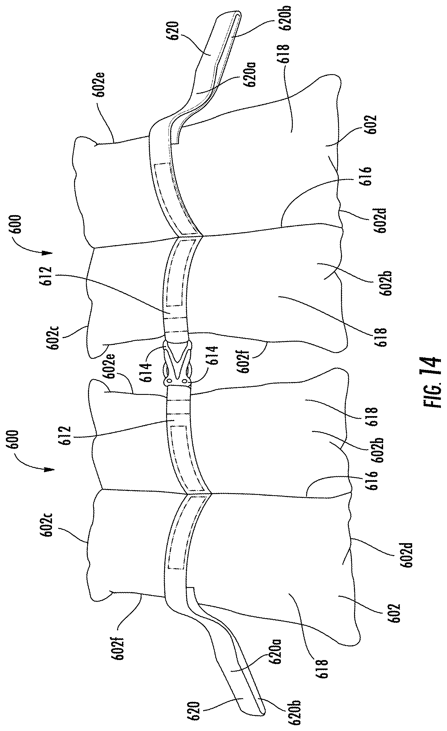 Patent US11793661 Figure 14 – Cushioned support system for heel ulcer prevention