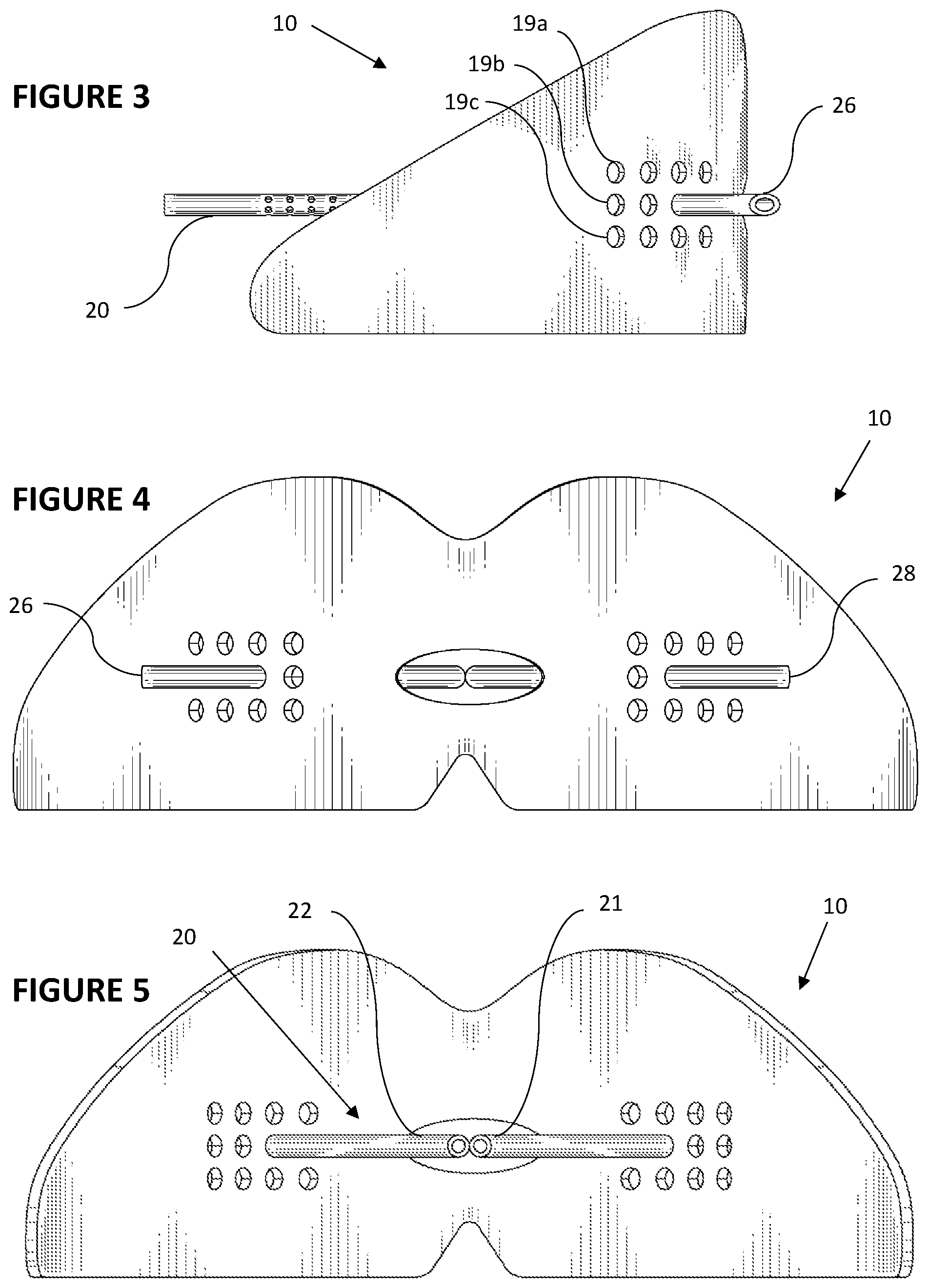 Patent US11793665 Figure 2 – Vented dental appliance for bruxism relief