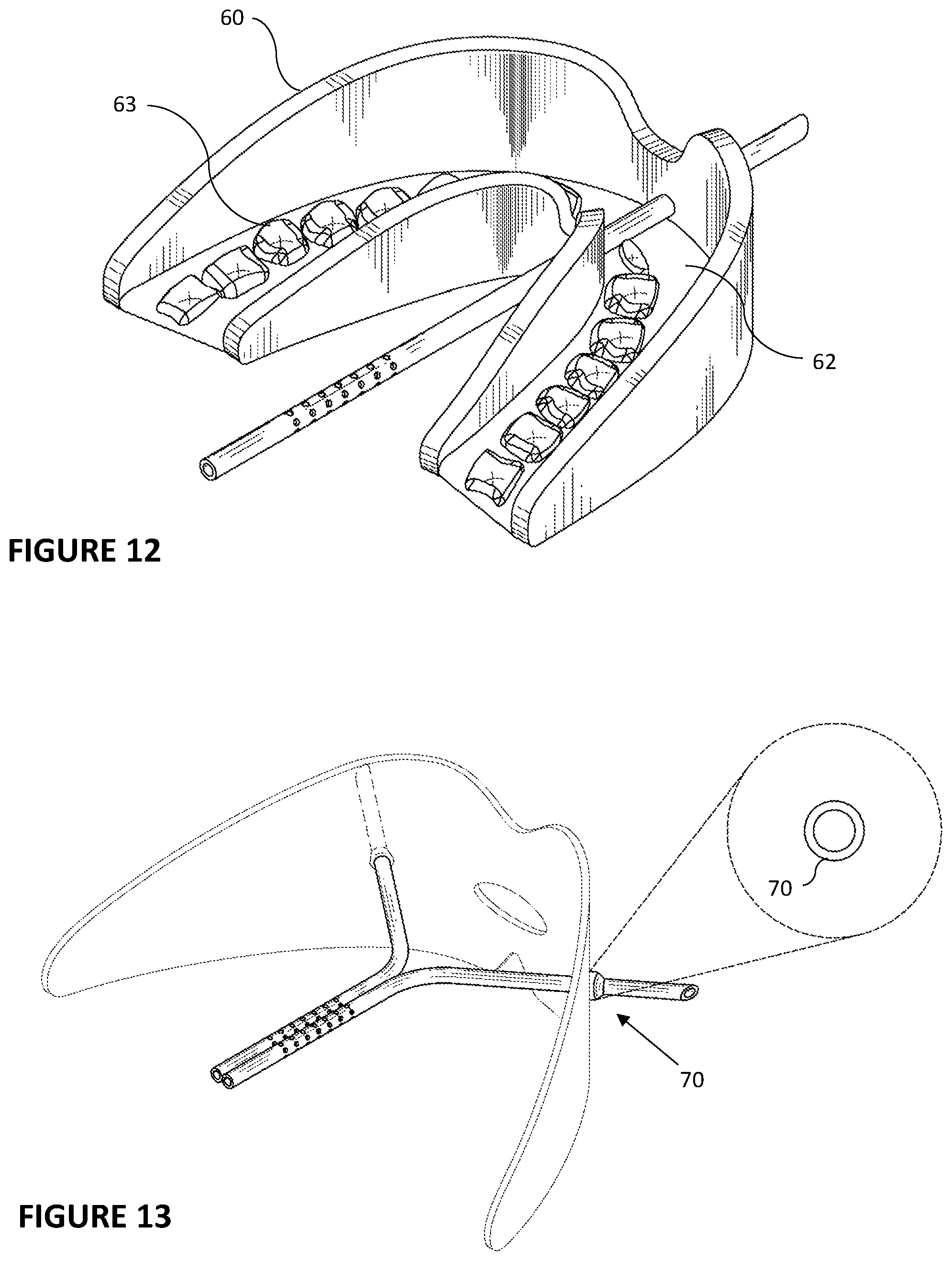Patent US11793665 Figure 6 – Vented dental appliance for bruxism relief