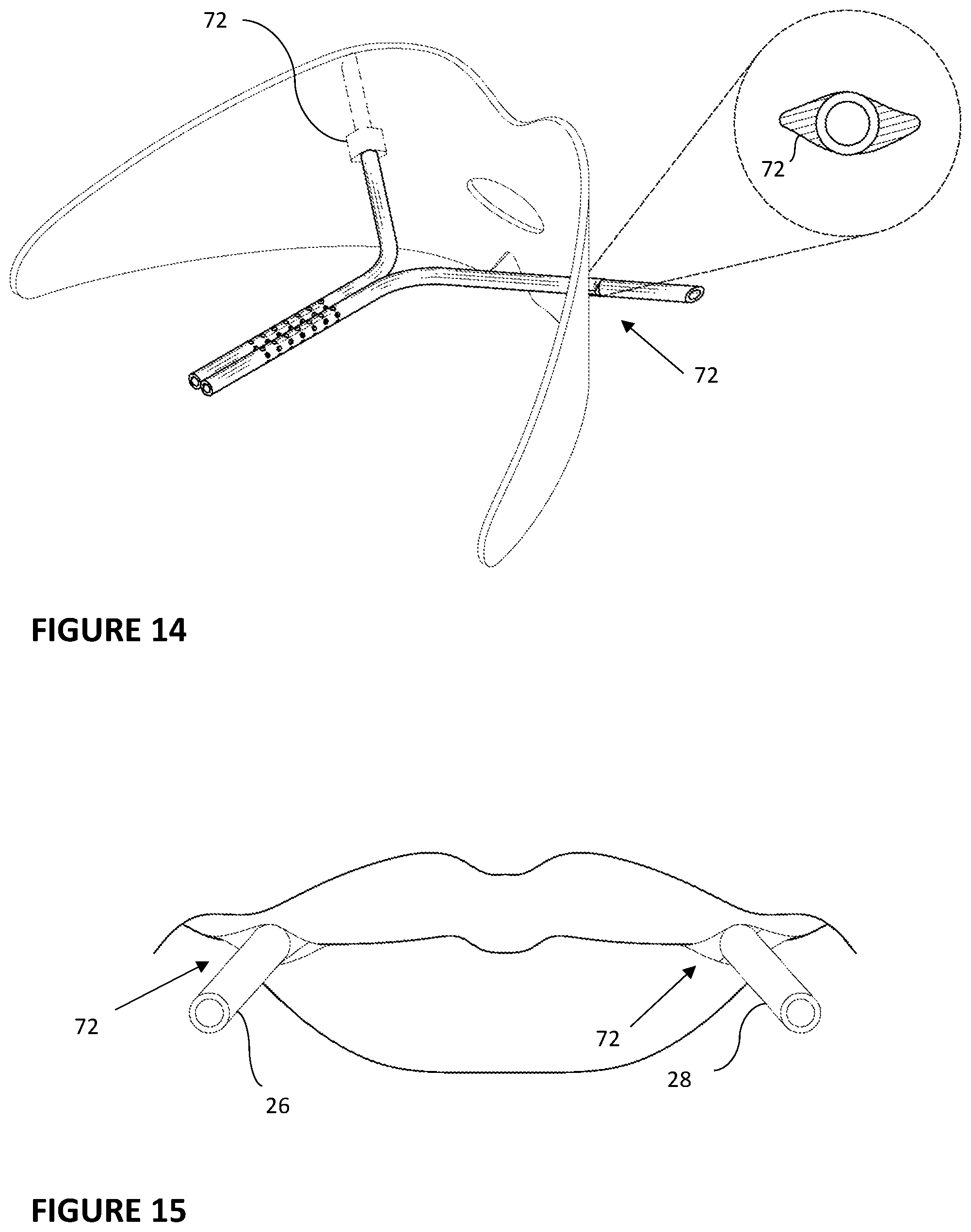 Patent US11793665 Figure 7 – Vented dental appliance for bruxism relief