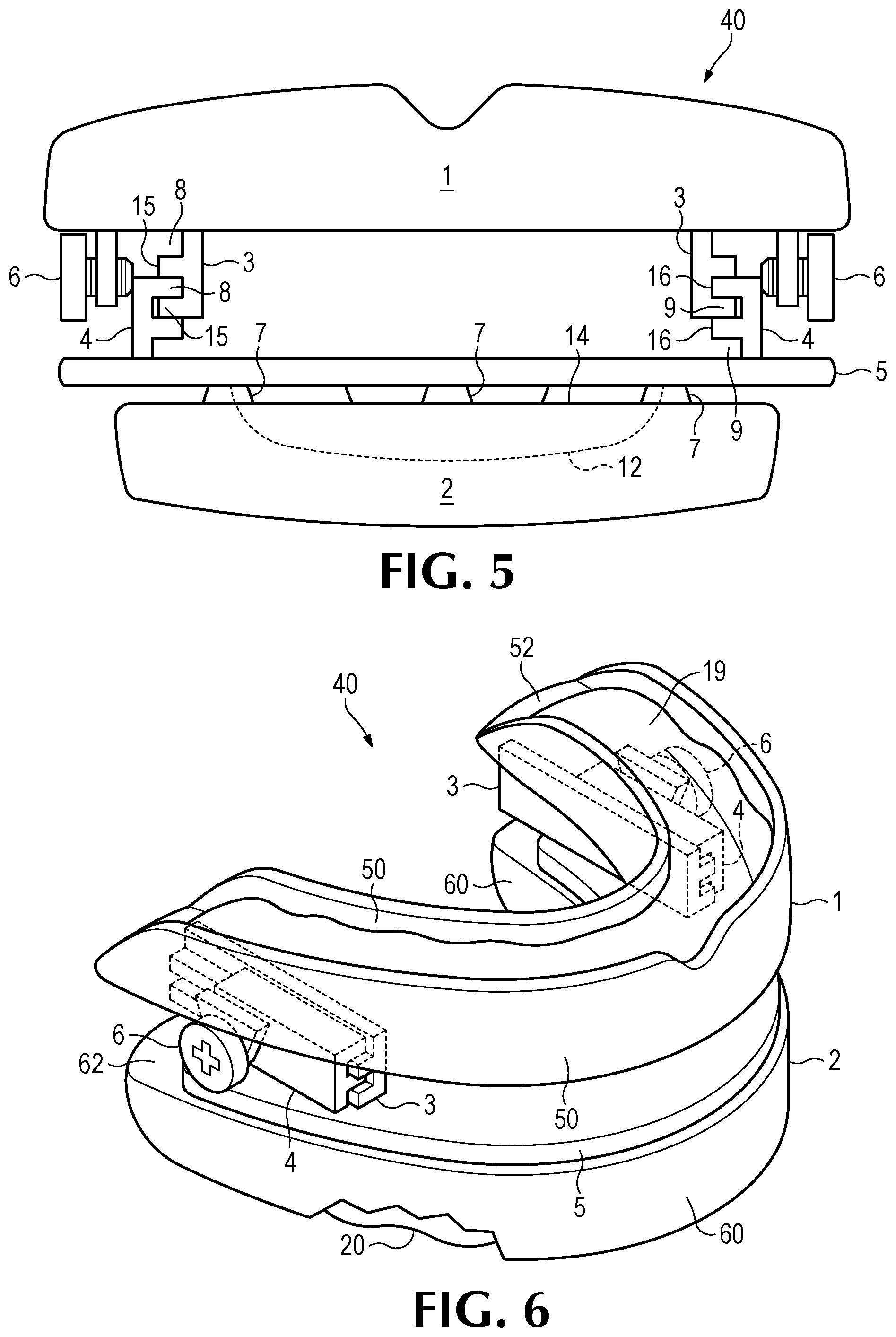 Patent US11793666 Figure 3 – Intra-oral snore and sleep apnea treatment appliance