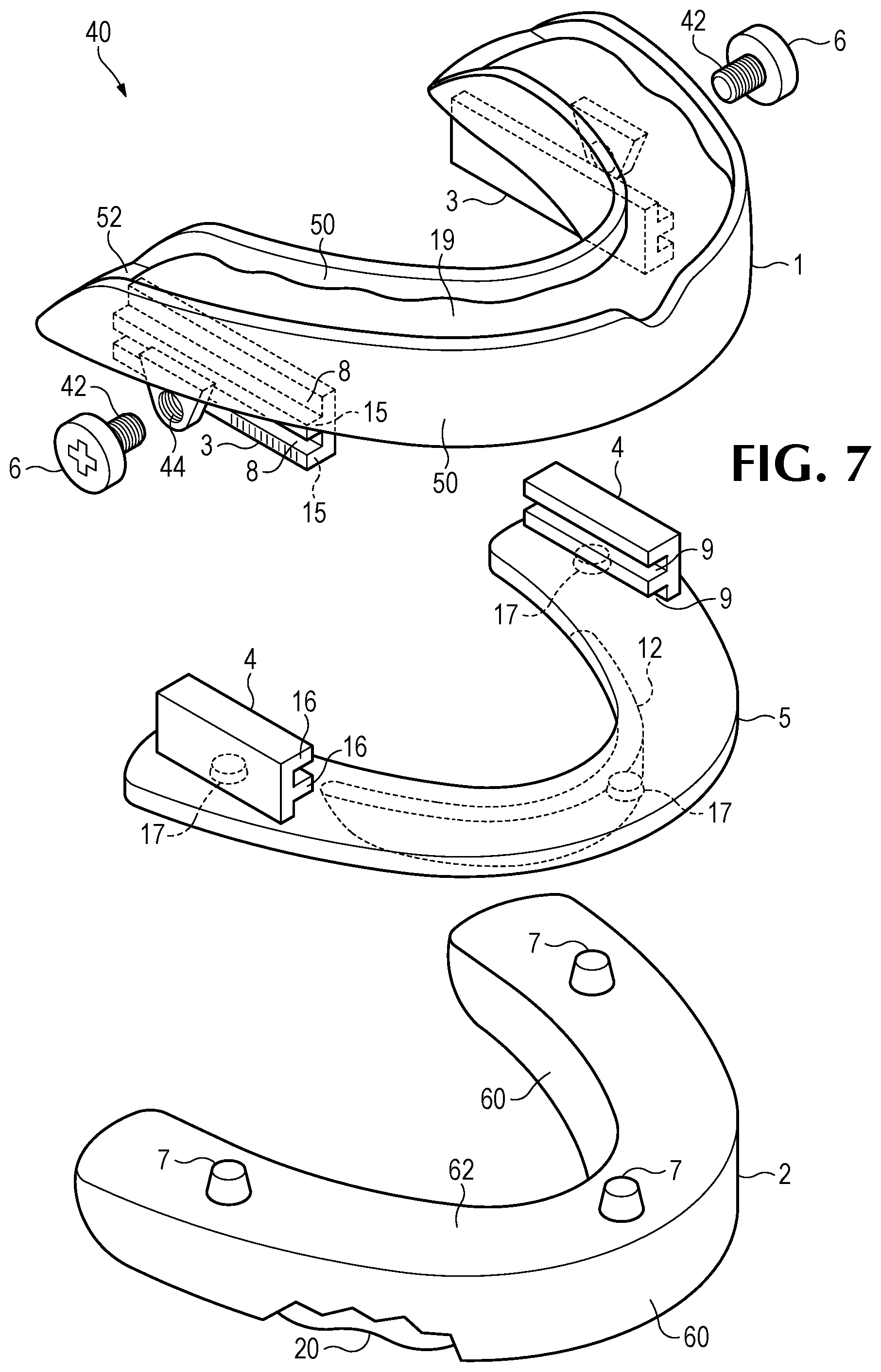 Patent US11793666 Figure 4 – Intra-oral snore and sleep apnea treatment appliance