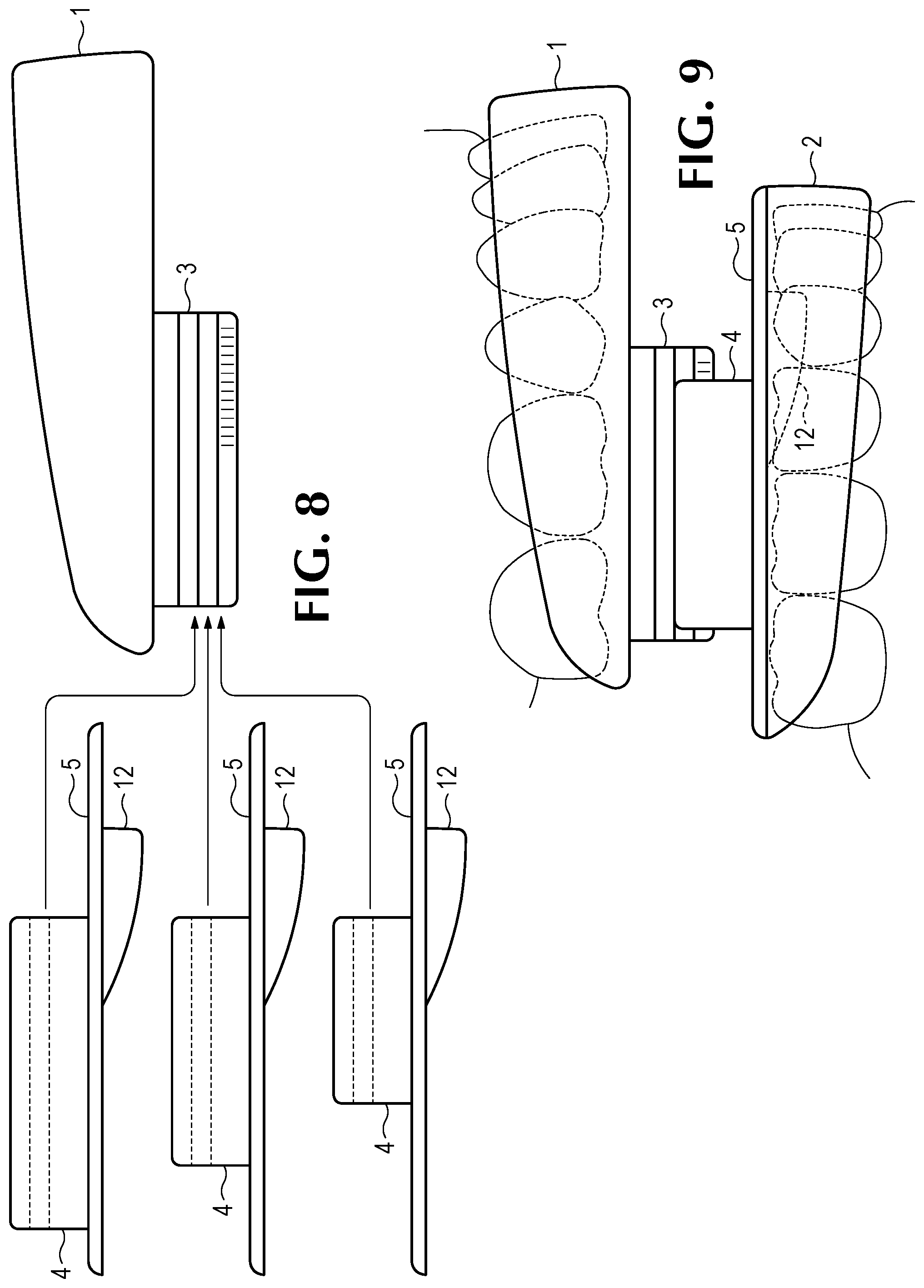 Patent US11793666 Figure 5 – Intra-oral snore and sleep apnea treatment appliance