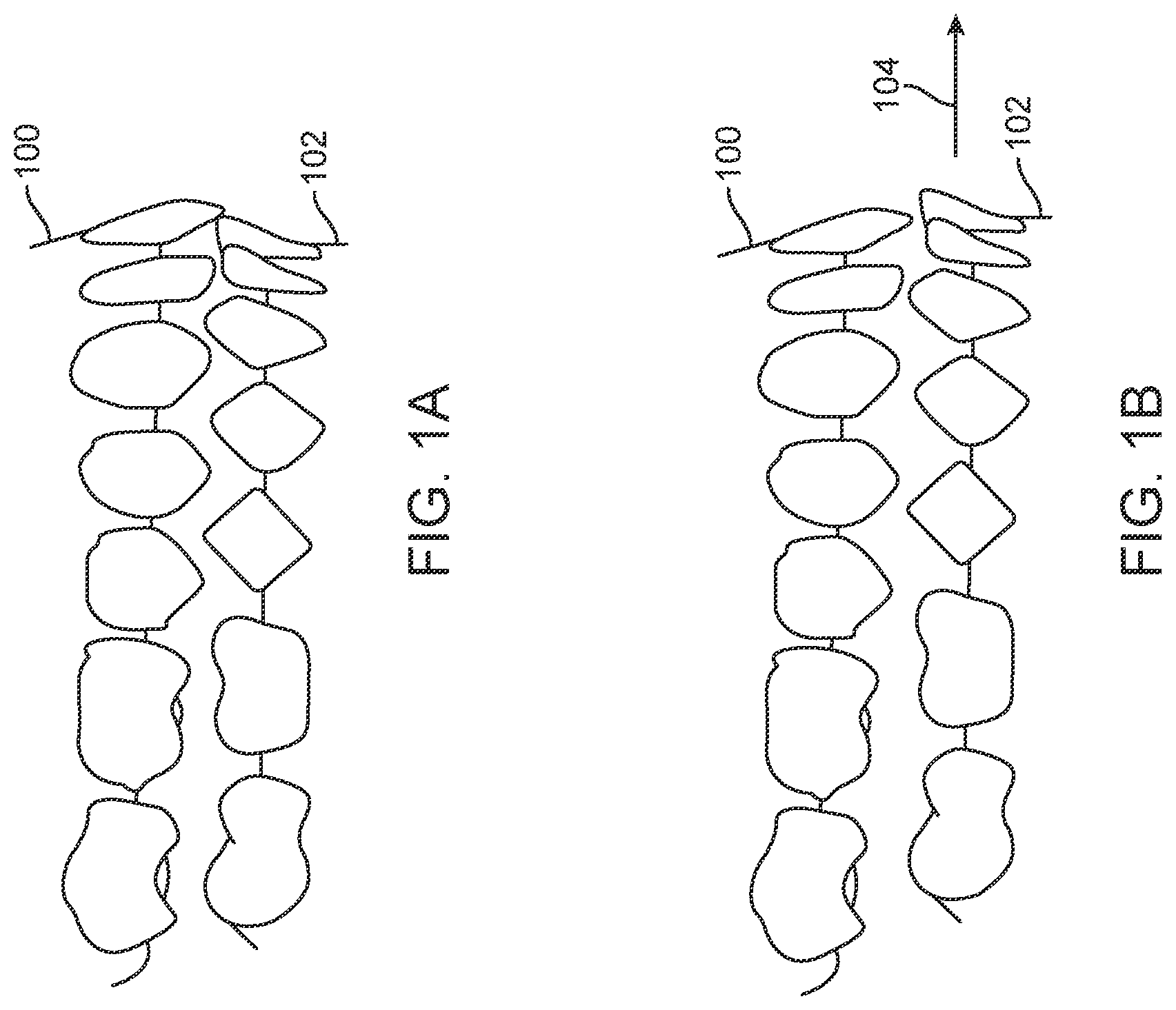 Patent US11793667 Figure 1 – Systems, methods, and devices for applying distributed forces for mandibular advancement