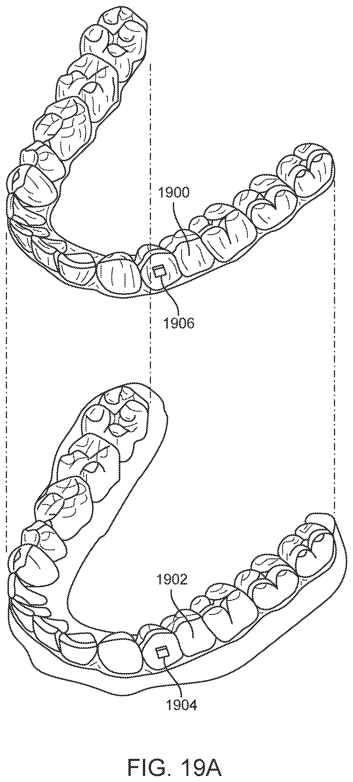 Patent US11793667 Figure 18 – Systems, methods, and devices for applying distributed forces for mandibular advancement