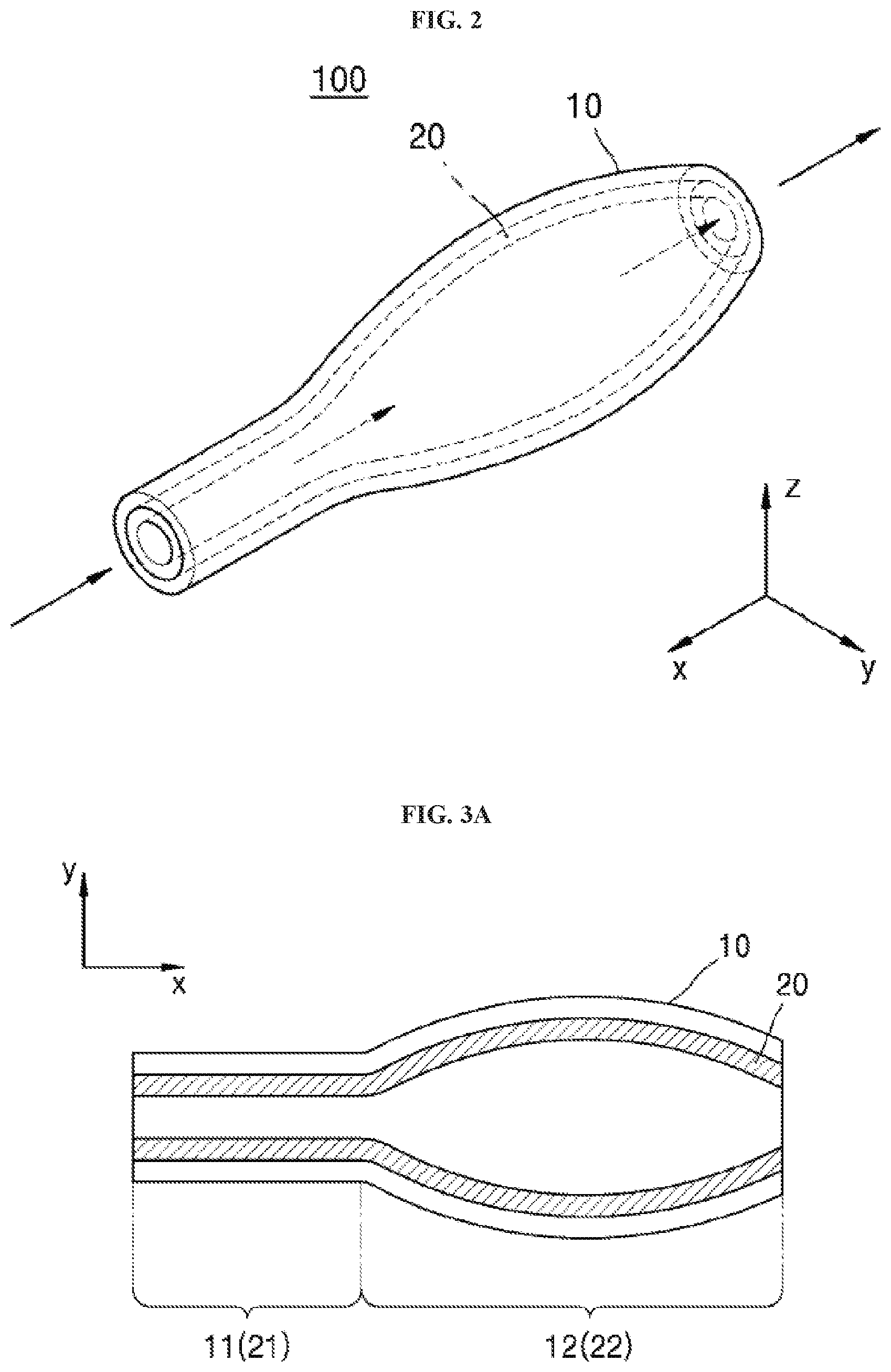 Patent US11793673 Figure 2 – Implant device for eye disease for adjusting intraocular pressure