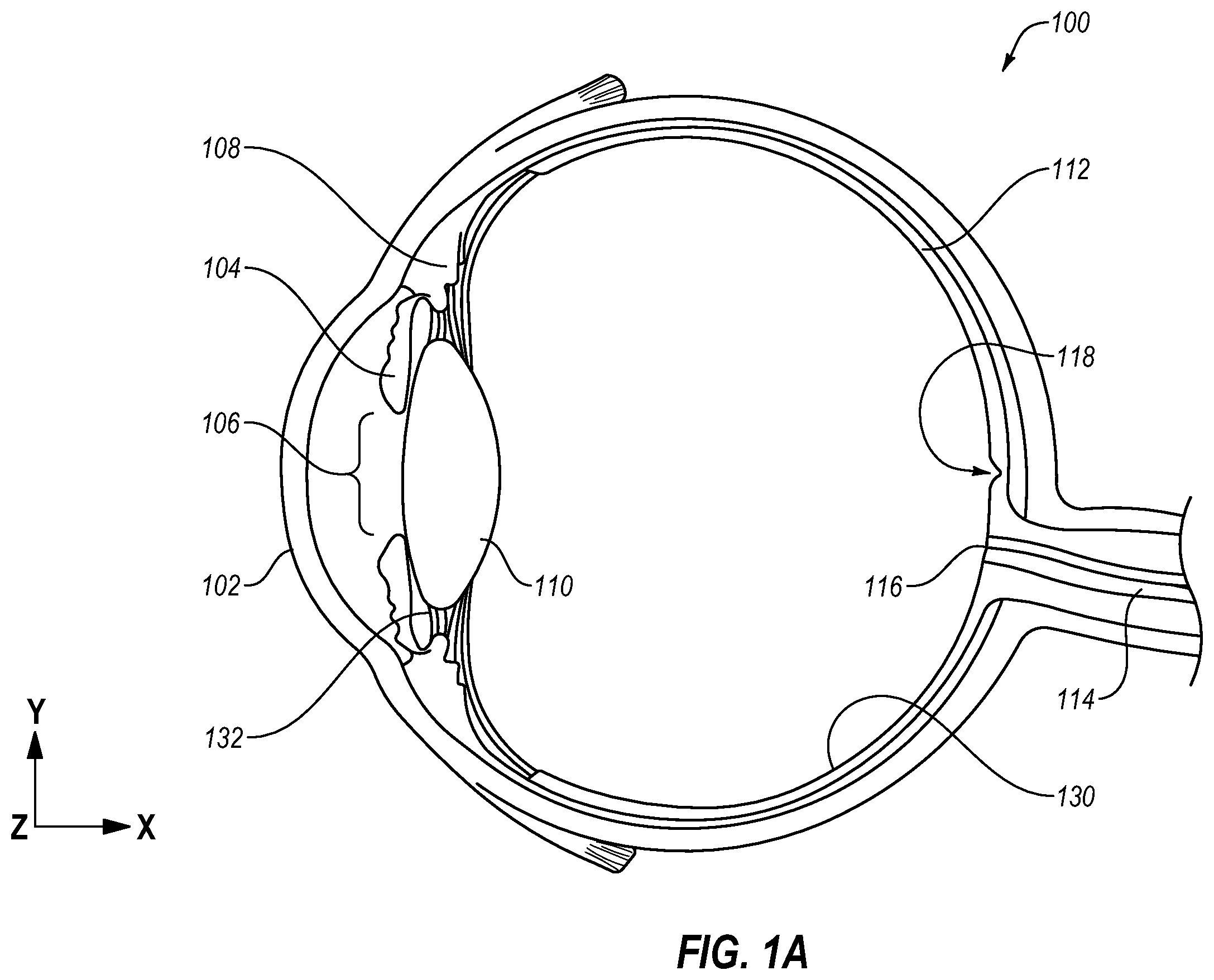 Patent US11793674 Figure 1 – Contact lenses with bifocal characteristics