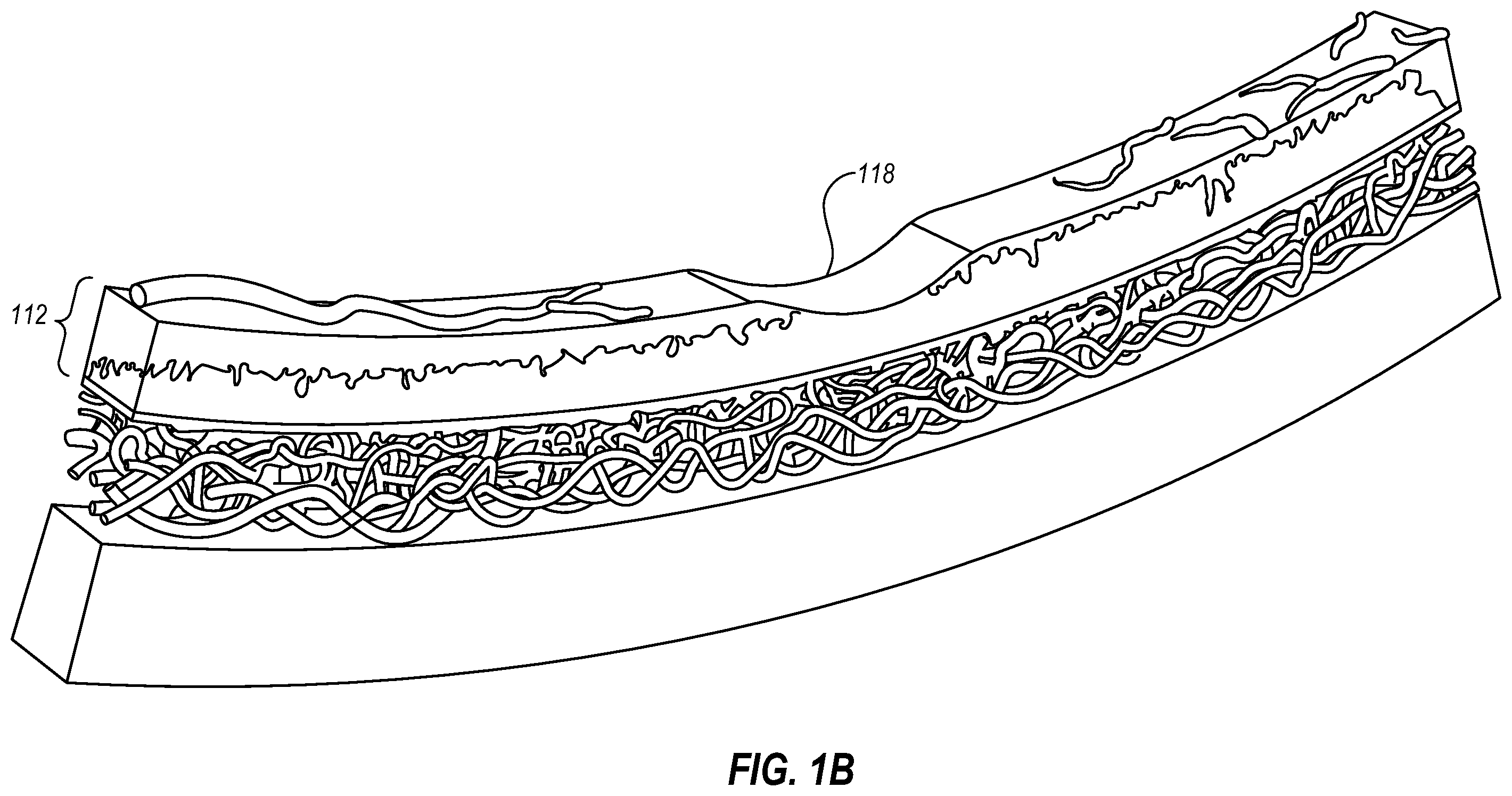 Patent US11793674 Figure 2 – Contact lenses with bifocal characteristics