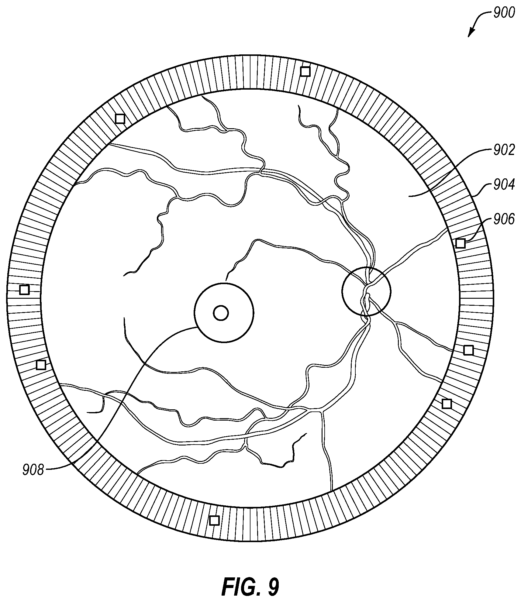 Patent US11793674 Figure 14 – Contact lenses with bifocal characteristics