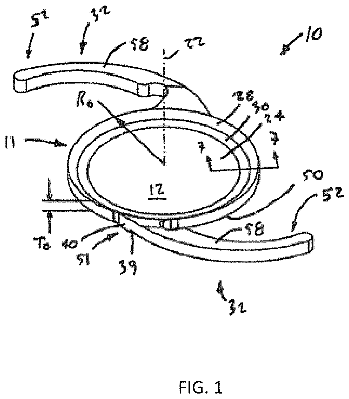 Patent US11793675 Figure 1 – Methods and systems for changing a refractive property of an implantable intraocular lens
