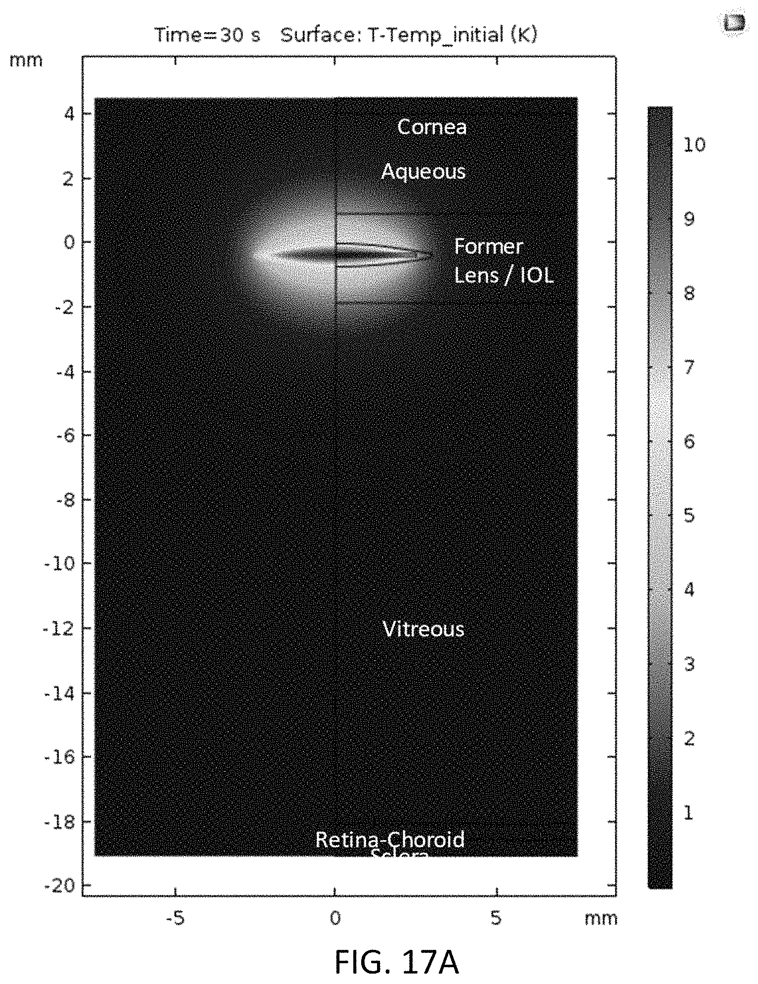 Patent US11793675 Figure 18 – Methods and systems for changing a refractive property of an implantable intraocular lens