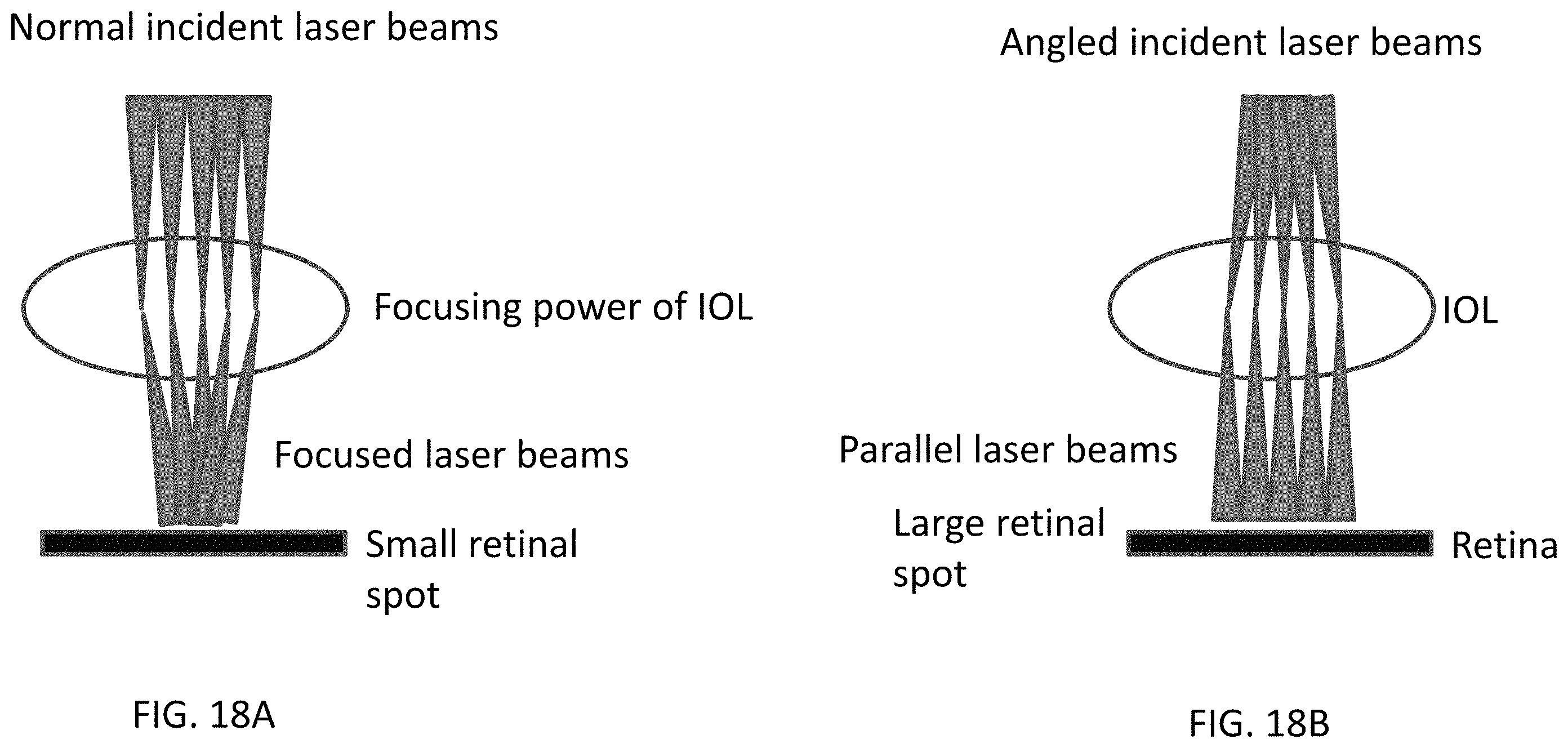 Patent US11793675 Figure 20 – Methods and systems for changing a refractive property of an implantable intraocular lens