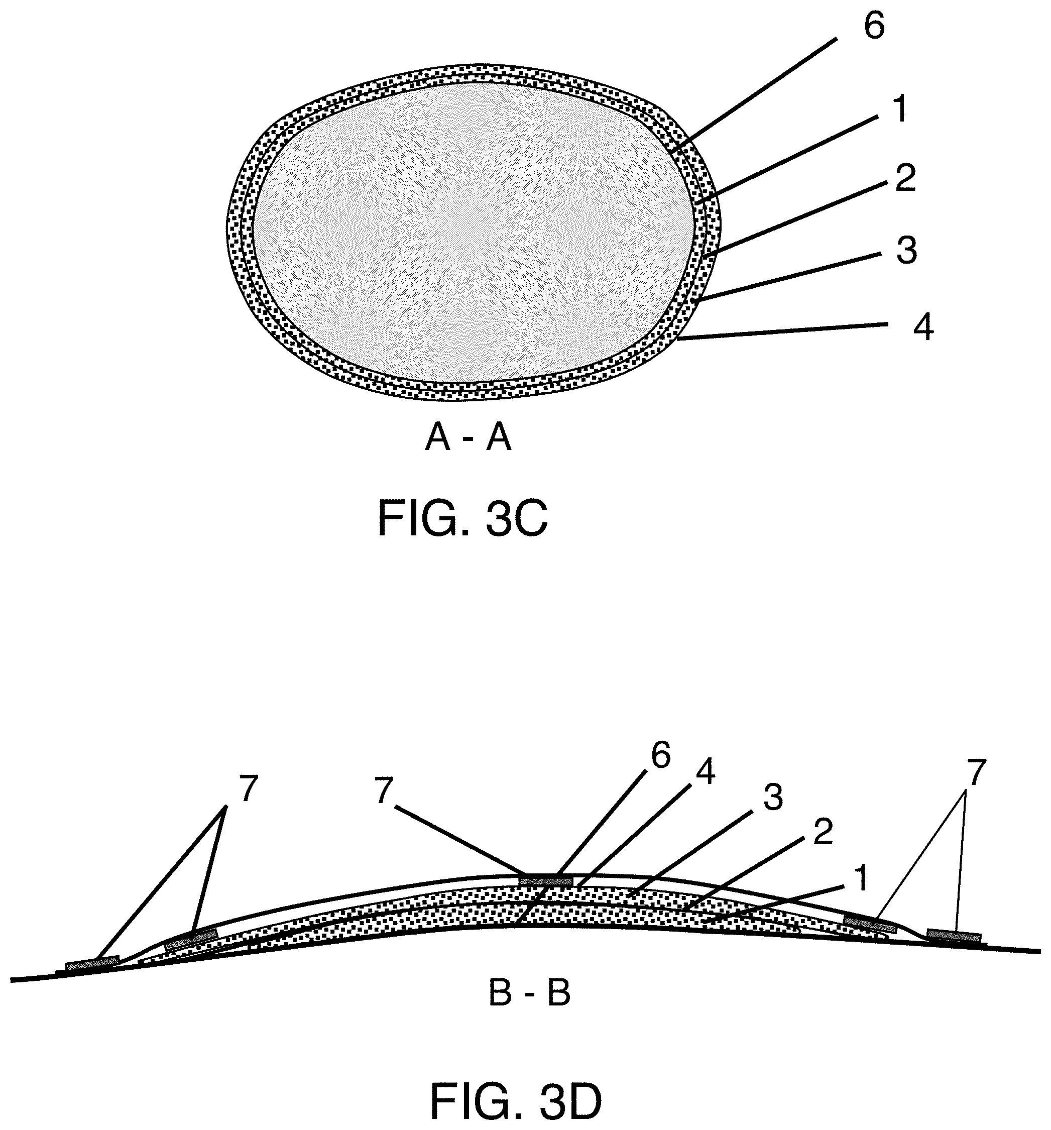 Patent US11793680 Figure 3 – Compound (multi-layer) waterproof bandage