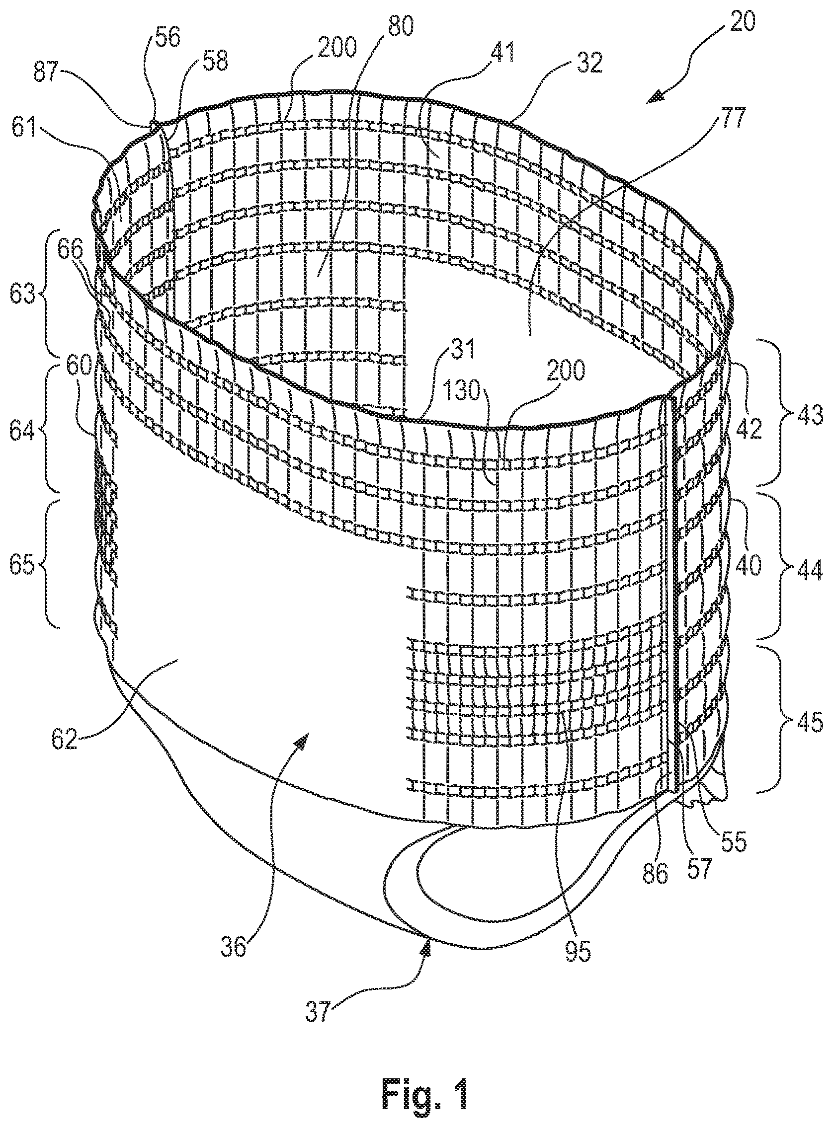 Patent US11793686 Figure 1 – Absorbent article with belt having profiled elasticity