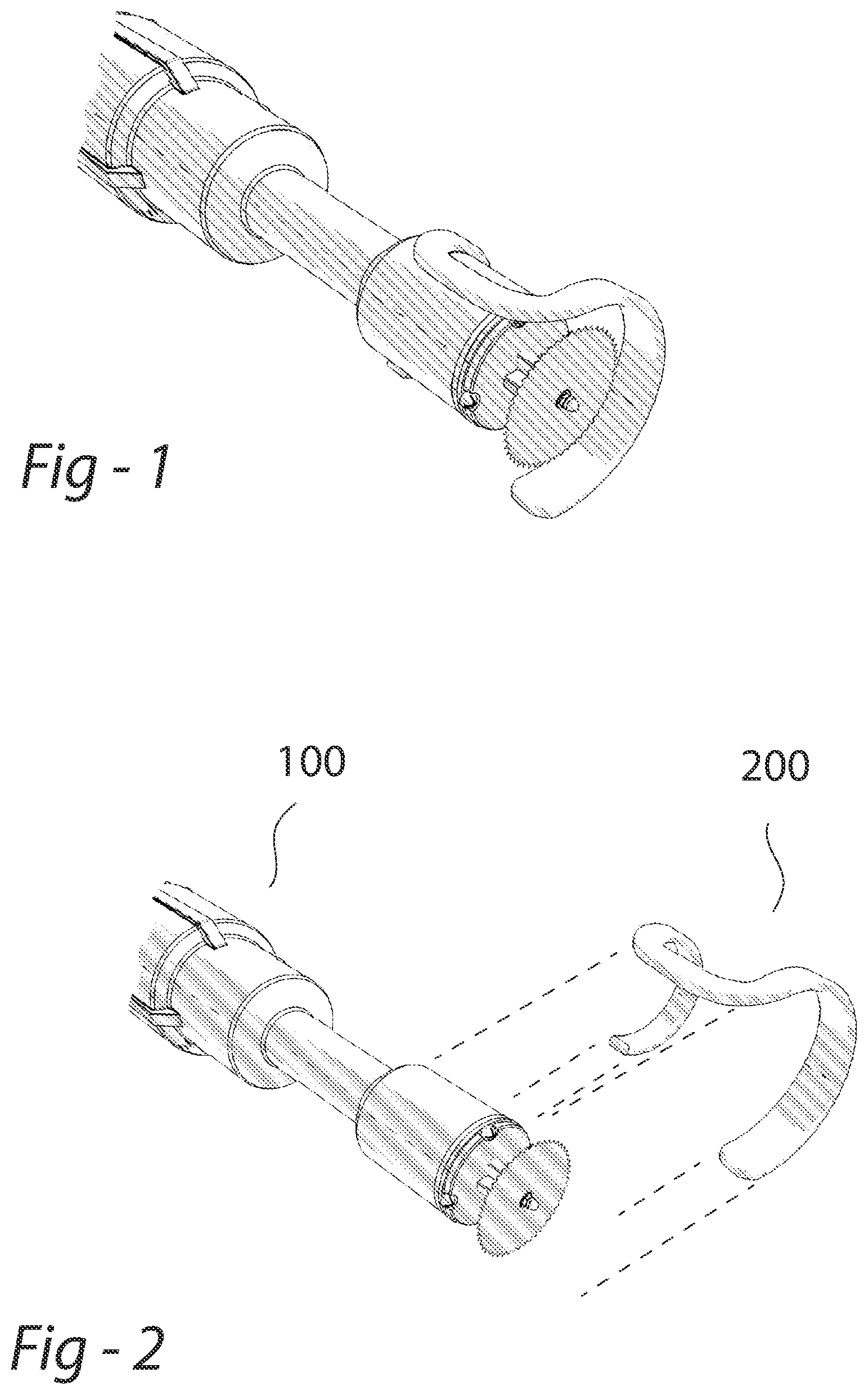 Patent US11793687 Figure 1 – Removable rubber bracelet for cast cutting