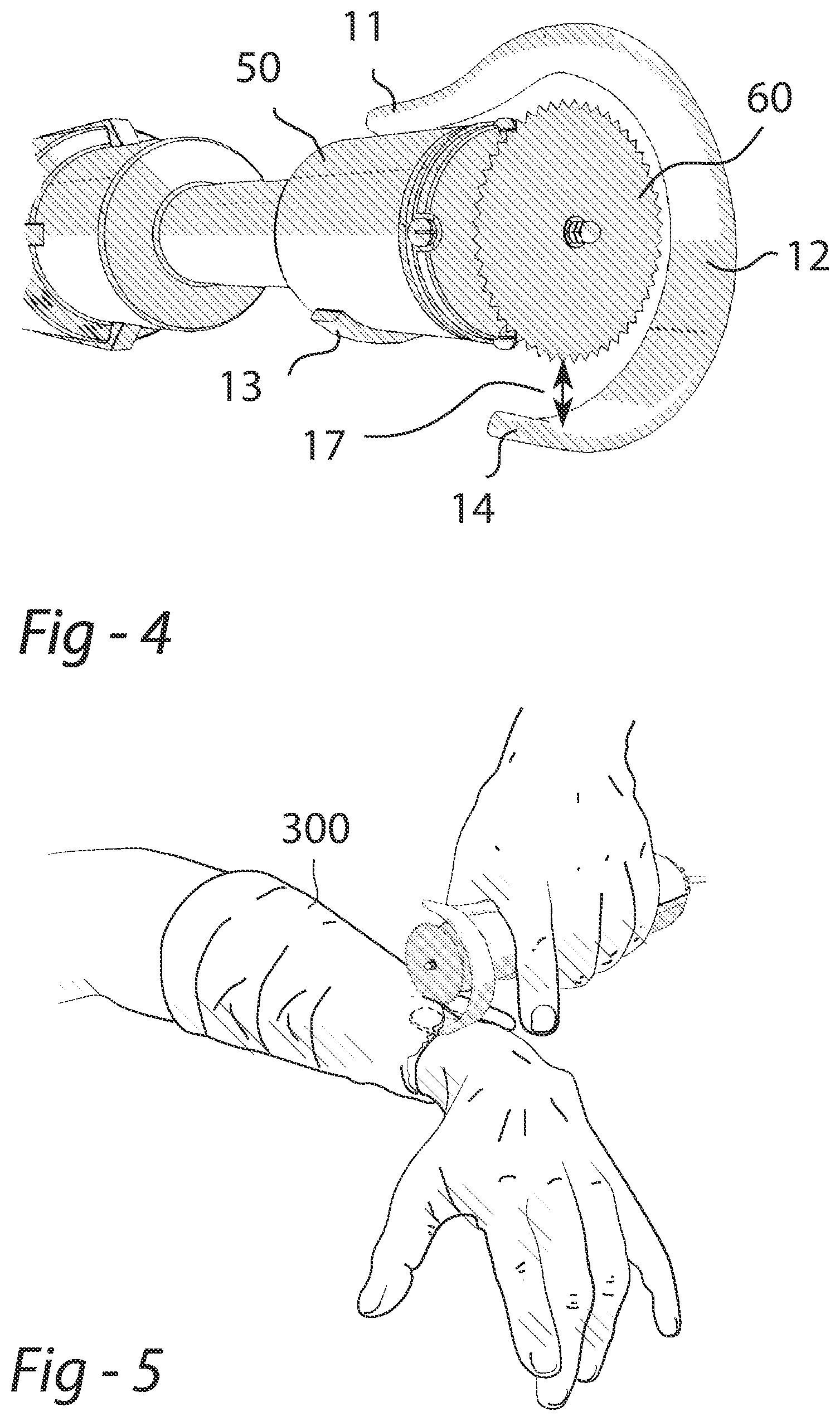 Patent US11793687 Figure 3 – Removable rubber bracelet for cast cutting