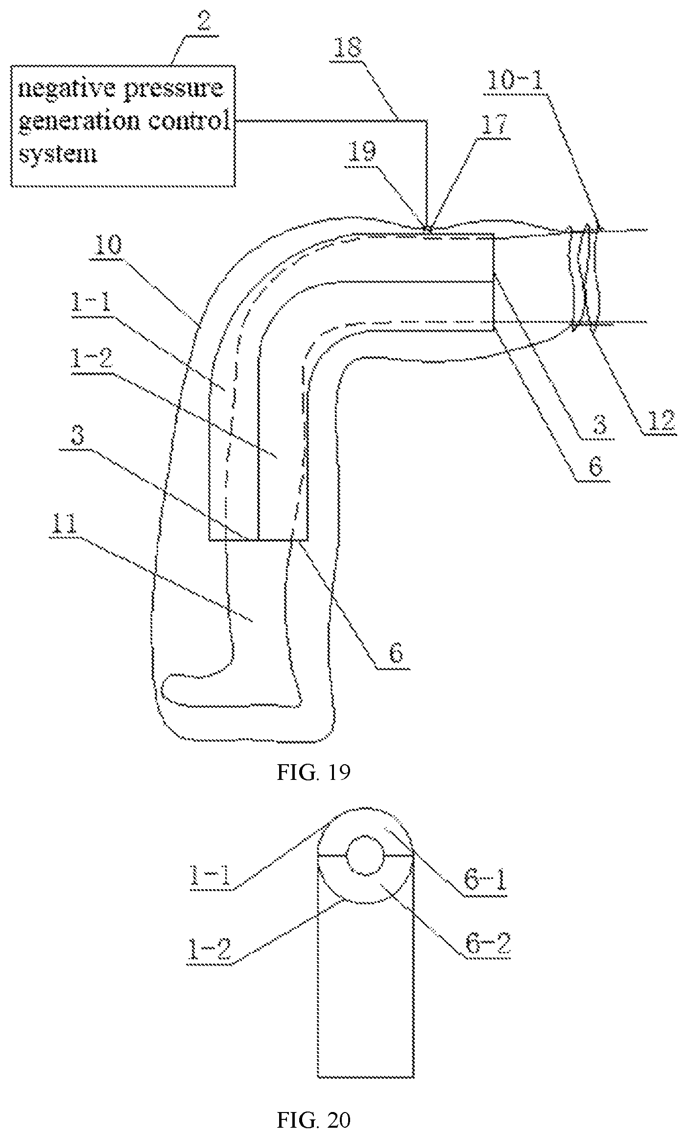 Patent US11793708 Figure 10 – Physiotherapy instrument for human body facet joint inflammation