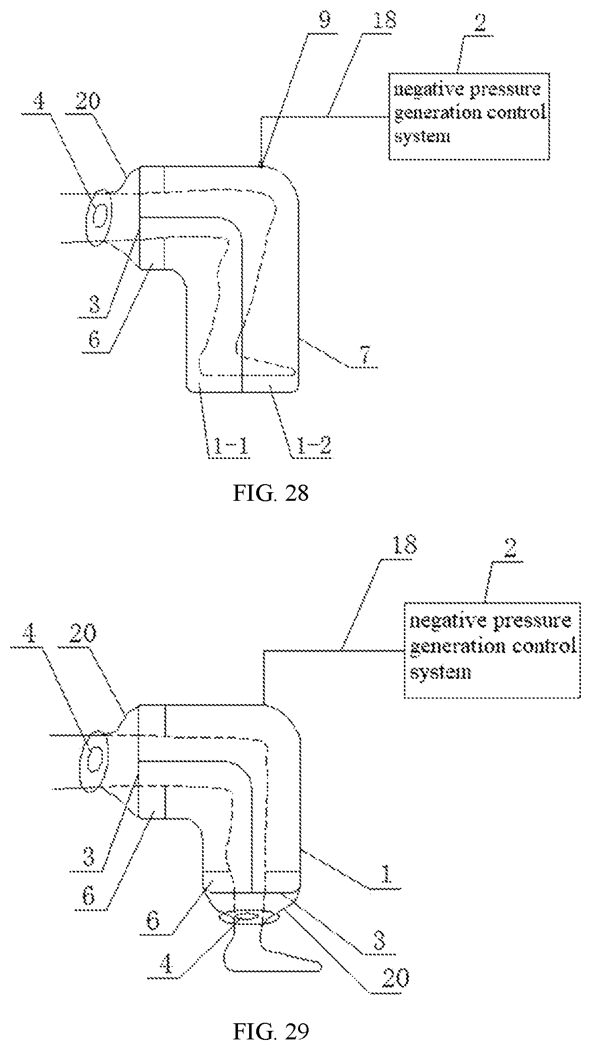 Patent US11793708 Figure 14 – Physiotherapy instrument for human body facet joint inflammation