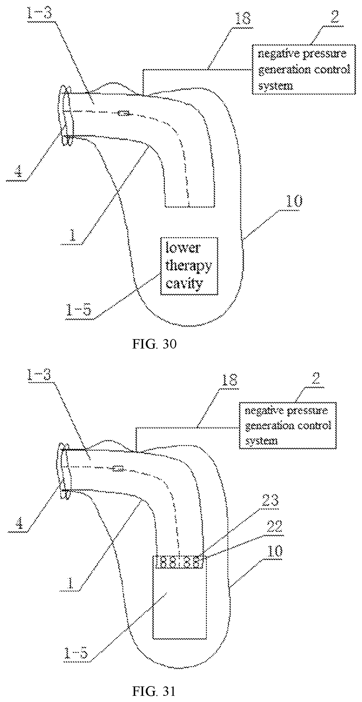 Patent US11793708 Figure 15 – Physiotherapy instrument for human body facet joint inflammation
