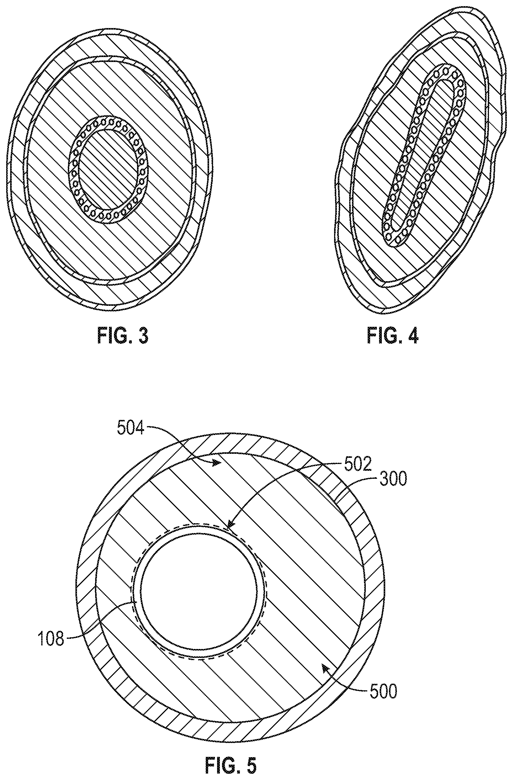 Patent US11793709 Figure 3 – Venous blood flow stimulator for extracorporeal therapy