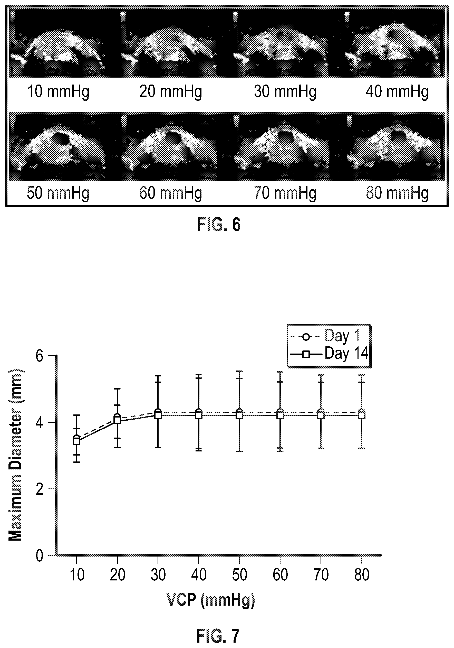 Patent US11793709 Figure 4 – Venous blood flow stimulator for extracorporeal therapy